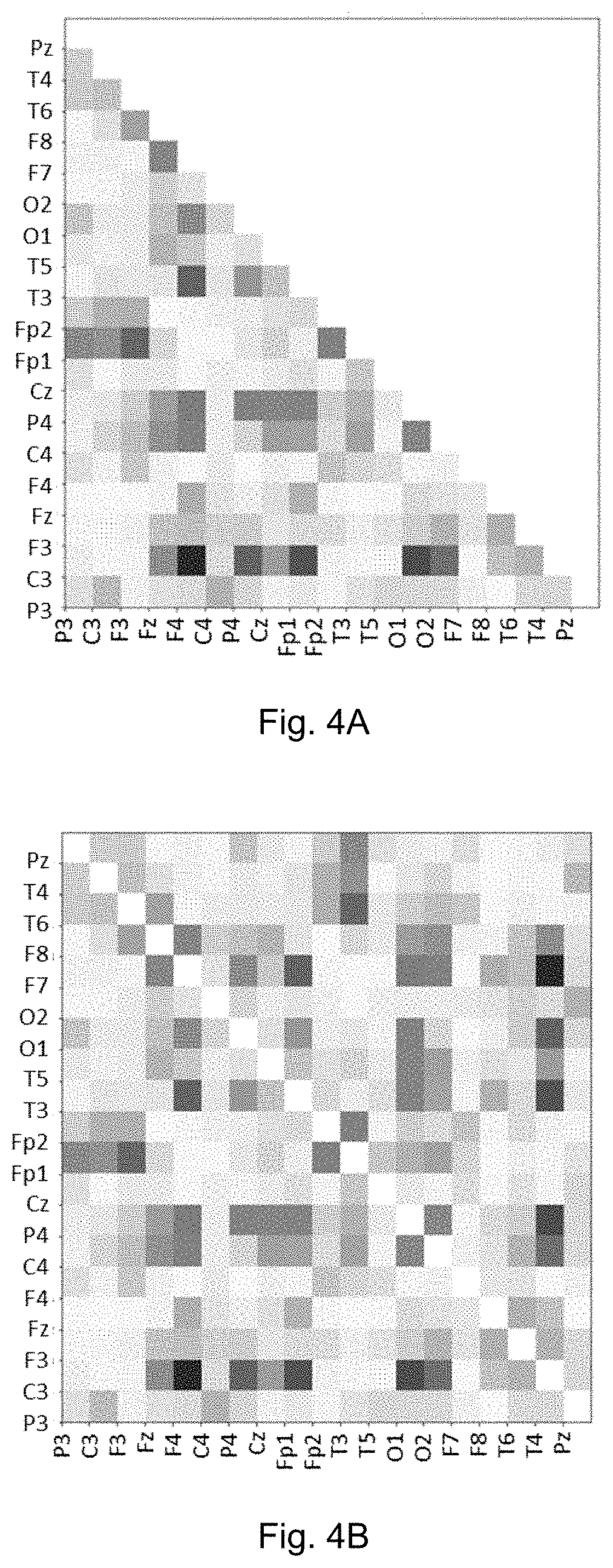 Patent US11771377 Figure 4 – Method and system for identifying cohorts of psychiatric disorder patients based on electroencephalograph