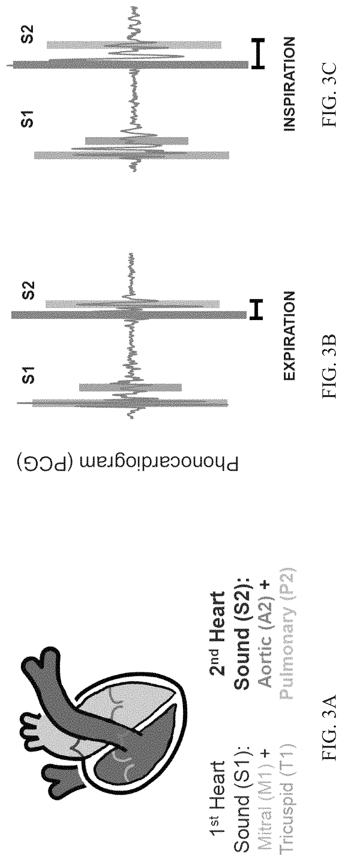 Patent US11771378 Figure 3 – Systems and methods for quantifying duration of heart sounds