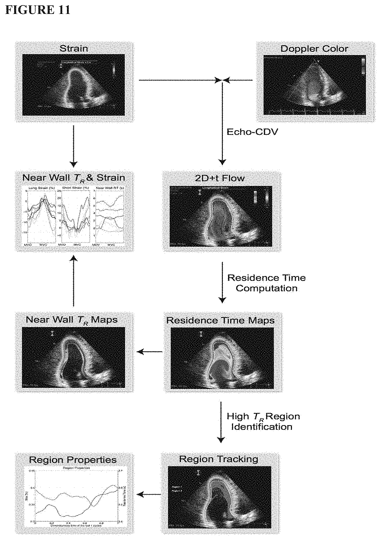 Patent US11771379 Figure 11 – Mapping and quantifying blood stasis and thrombus risk in the heart