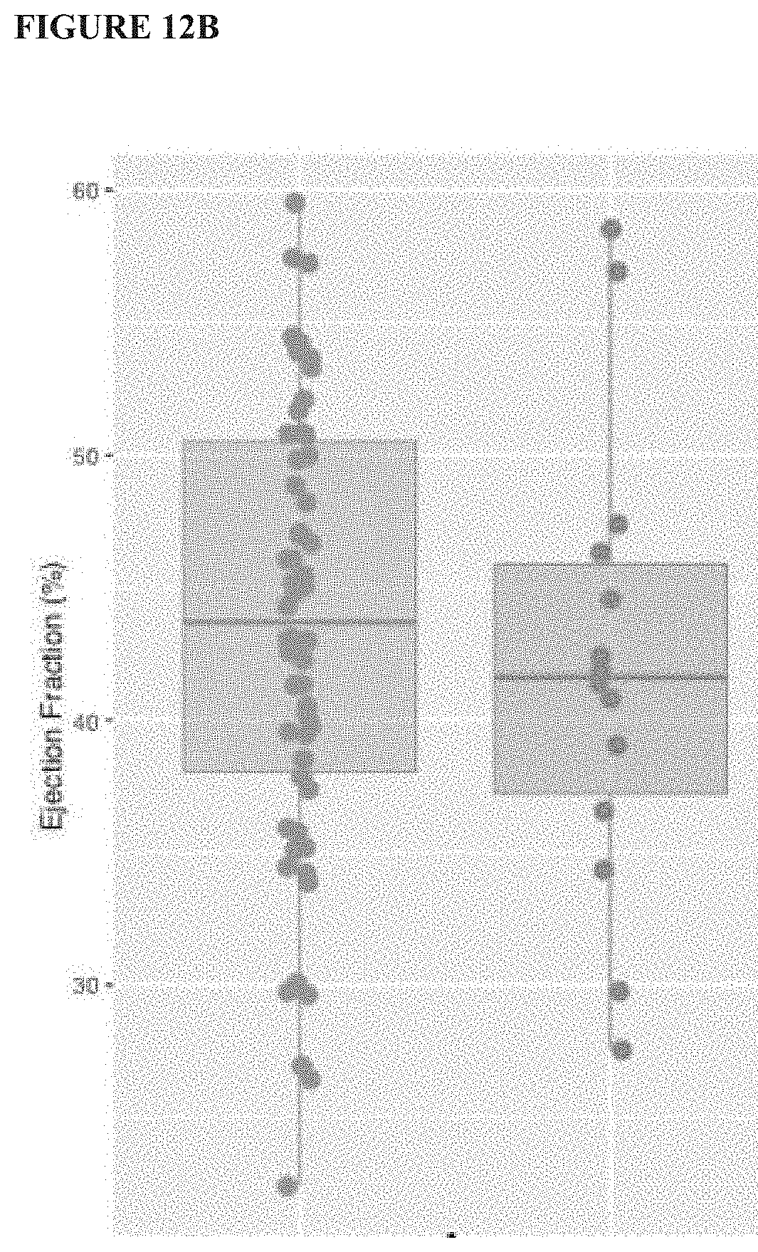 Patent US11771379 Figure 13 – Mapping and quantifying blood stasis and thrombus risk in the heart