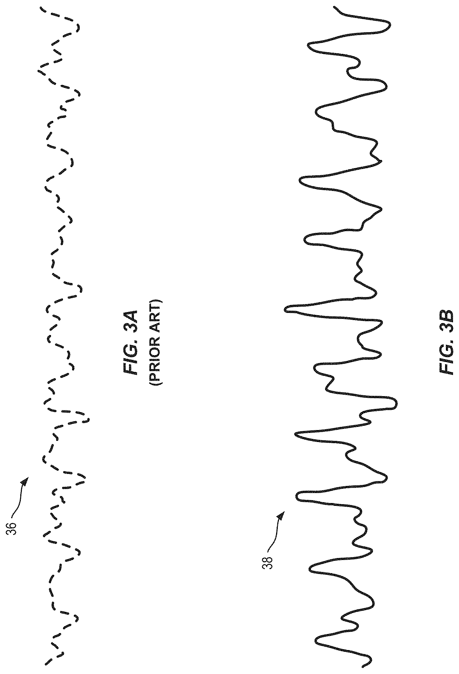 Patent US11771380 Figure 3 – Vital sign monitoring system using an optical sensor
