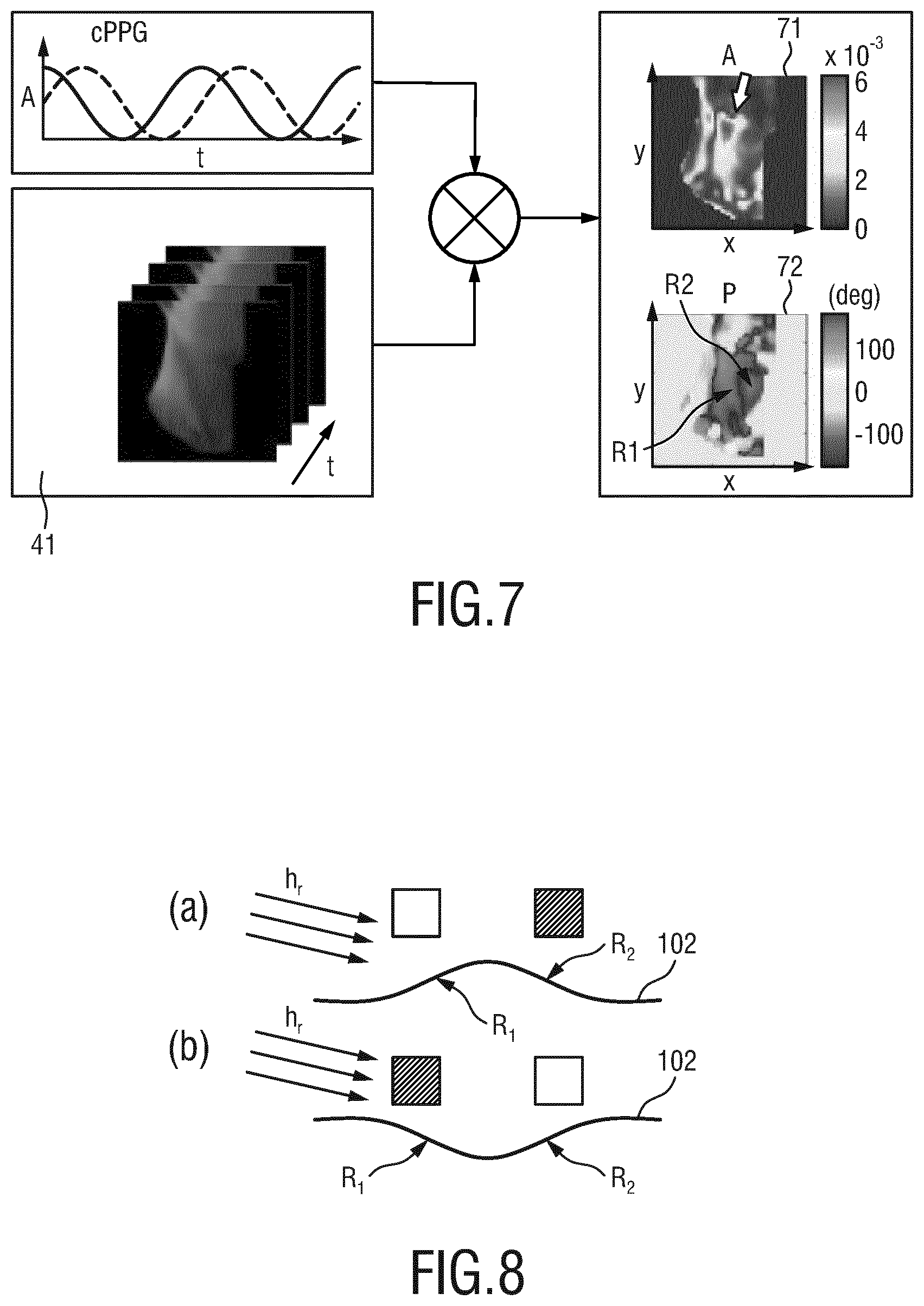 Patent US11771381 Figure 4 – Device, system and method for measuring and processing physiological signals of a subject