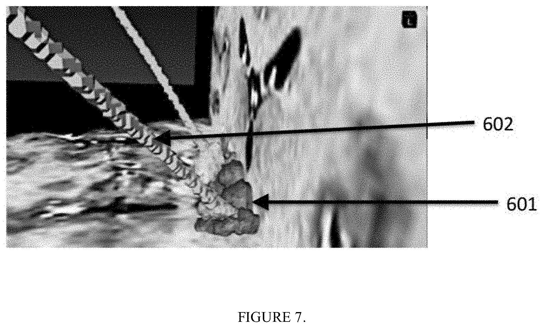 Patent US11771389 Figure 7 – Method for a brain region location and shape prediction