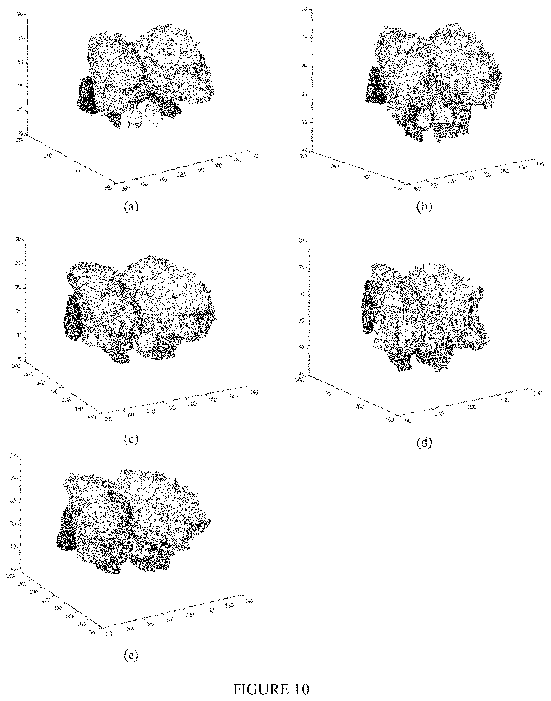 Patent US11771389 Figure 10 – Method for a brain region location and shape prediction