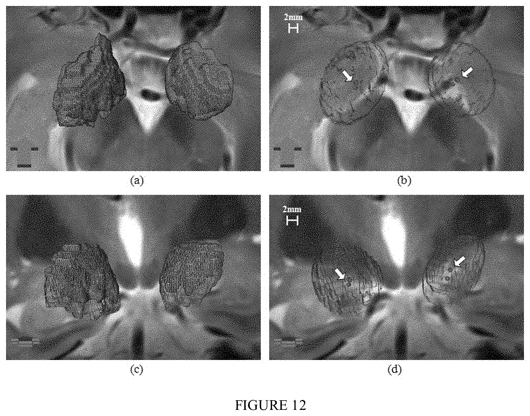 Patent US11771389 Figure 12 – Method for a brain region location and shape prediction