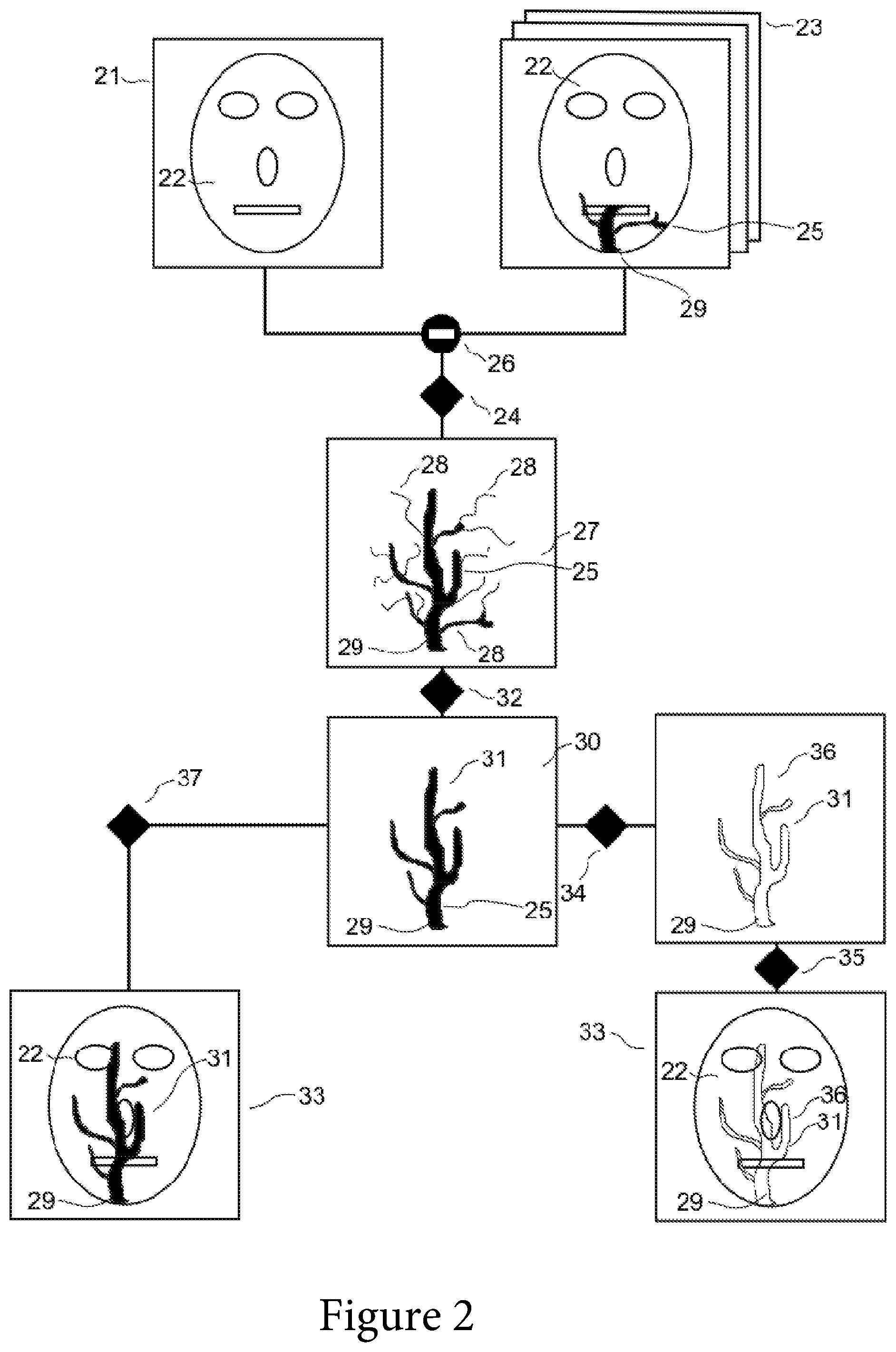 Patent US11771390 Figure 2 – Method and device for determining the contour of anatomical structures in a digital X-ray-based fluoroscopic image