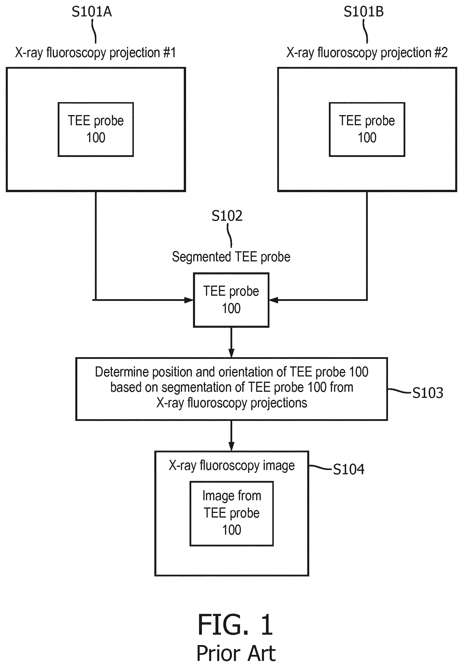 Patent US11771392 — Multi-modal imaging alignment — Figure 1
