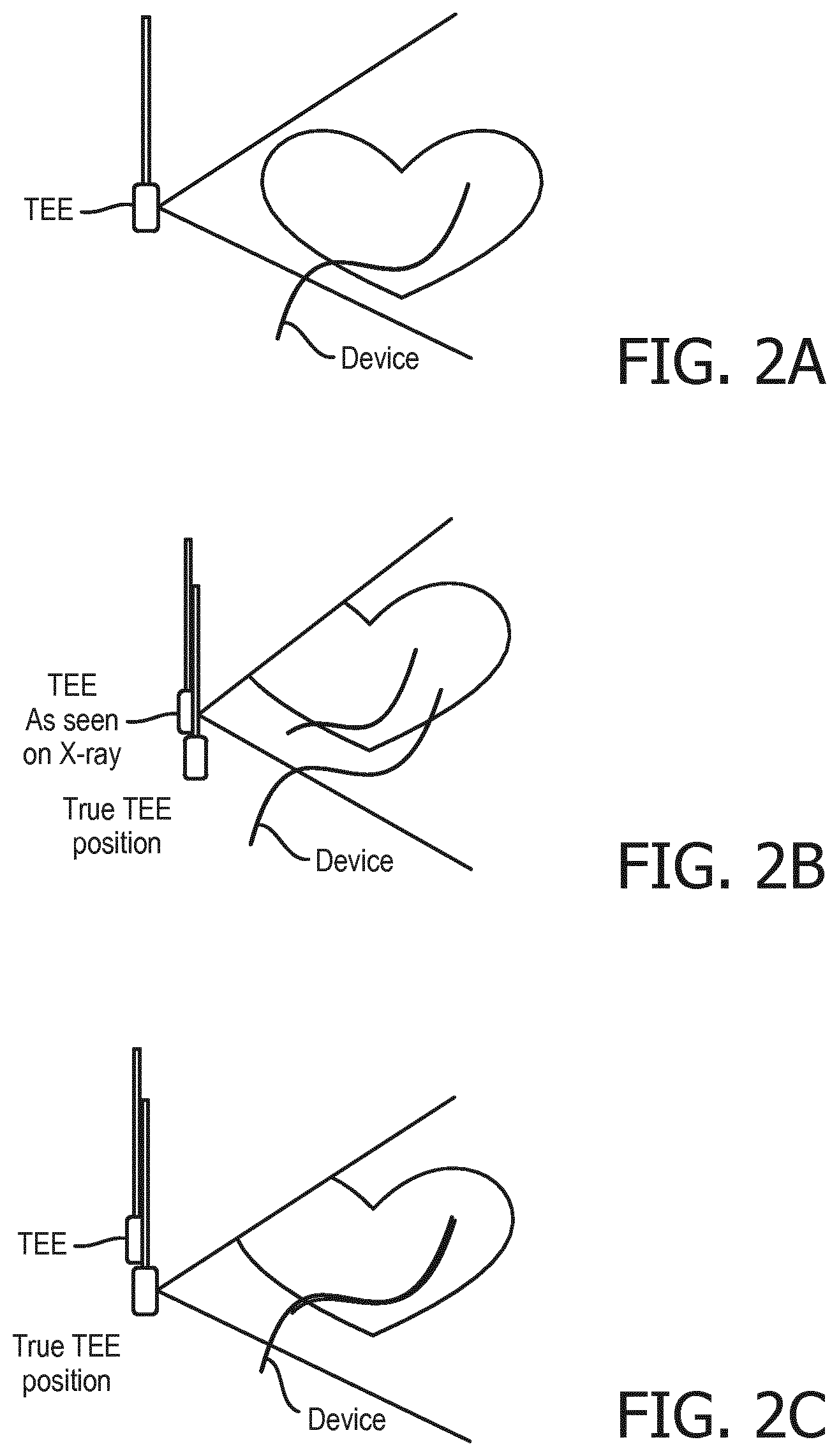 Patent US11771392 Figure 2 – Multi-modal imaging alignment