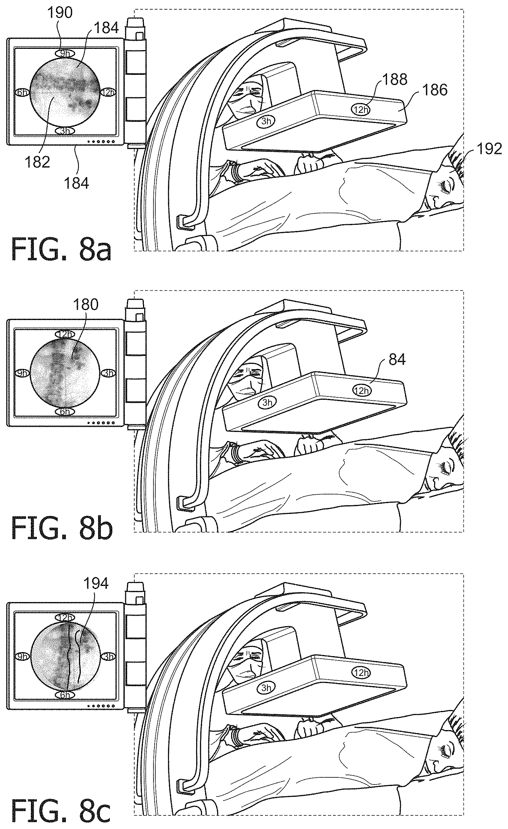 Patent US11771395 Figure 7 – Orientation reference system for medical imaging