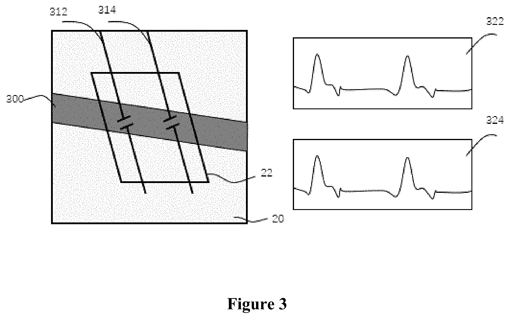 Patent US11771397 Figure 3 – Method and device for simultaneously carrying out blood flow doppler imaging and pulse doppler imaging