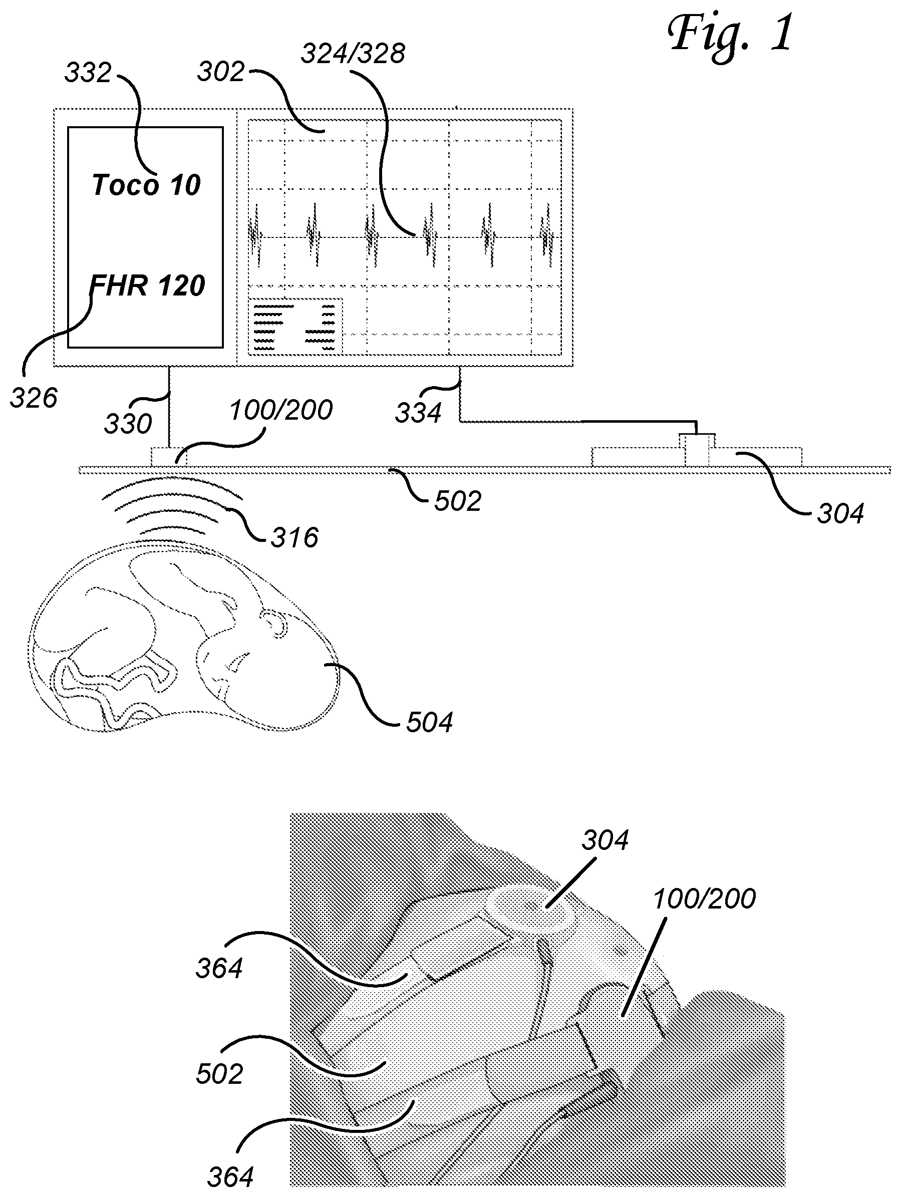 Patent US11771398 Figure 1 – Fetal heart rate transducer