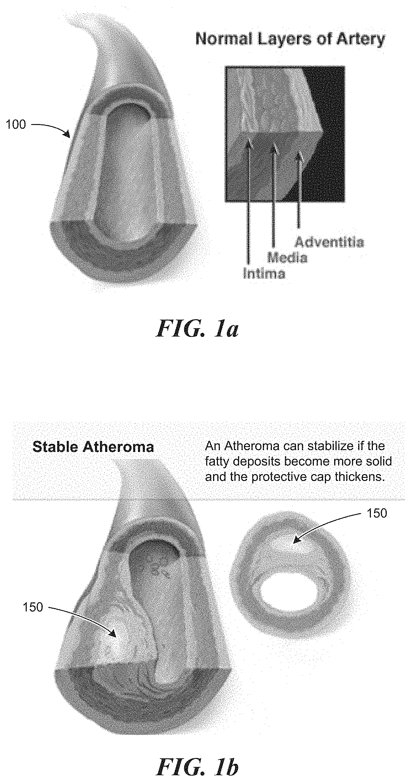 Patent US11771399 Figure 1 – Apparatus and method to guide ultrasound acquisition of the peripheral arteries in the transverse plane