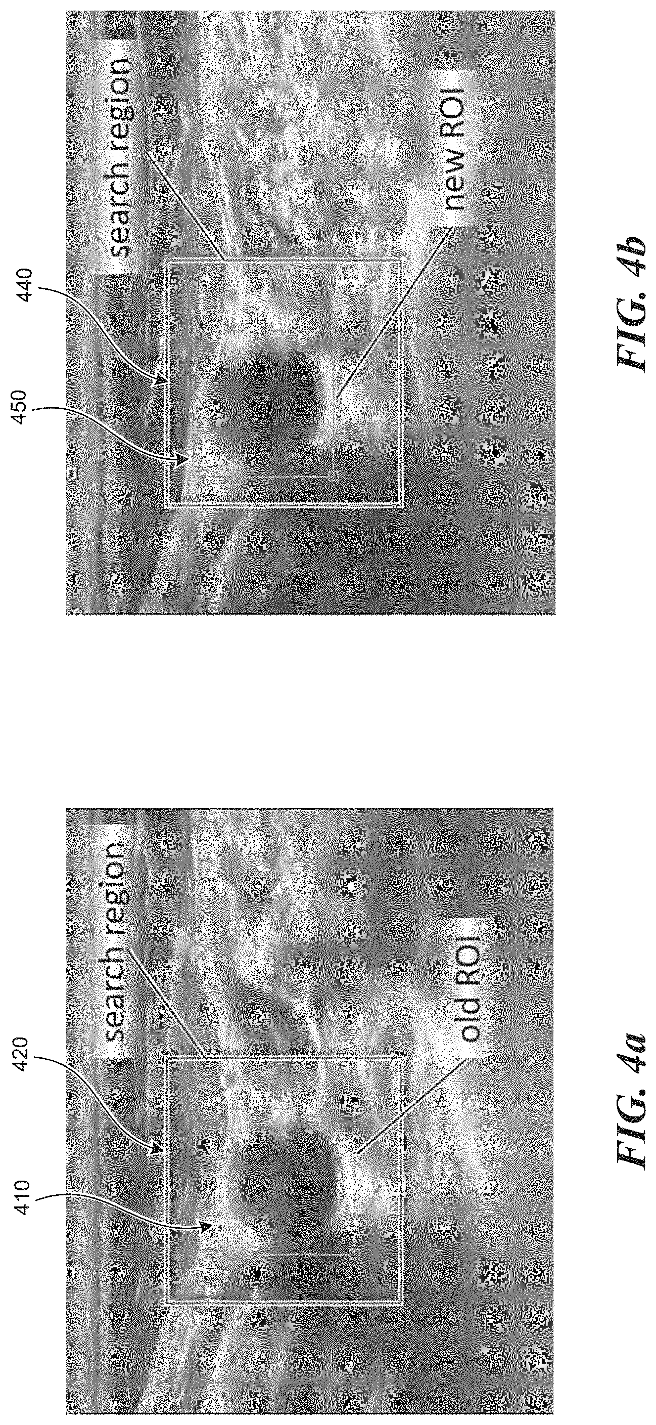 Patent US11771399 Figure 4 – Apparatus and method to guide ultrasound acquisition of the peripheral arteries in the transverse plane