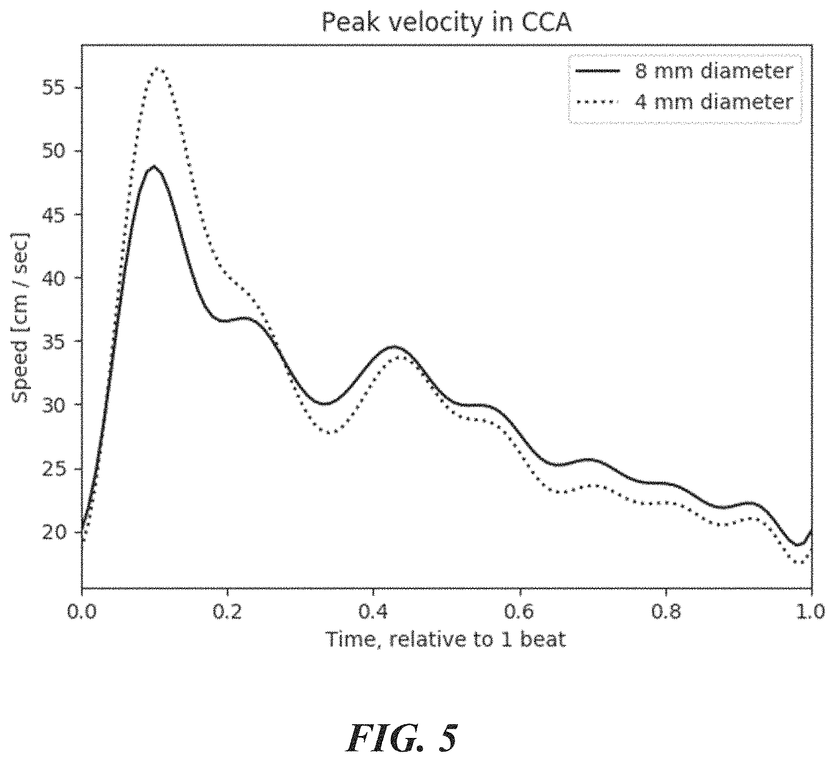 Patent US11771399 Figure 5 – Apparatus and method to guide ultrasound acquisition of the peripheral arteries in the transverse plane