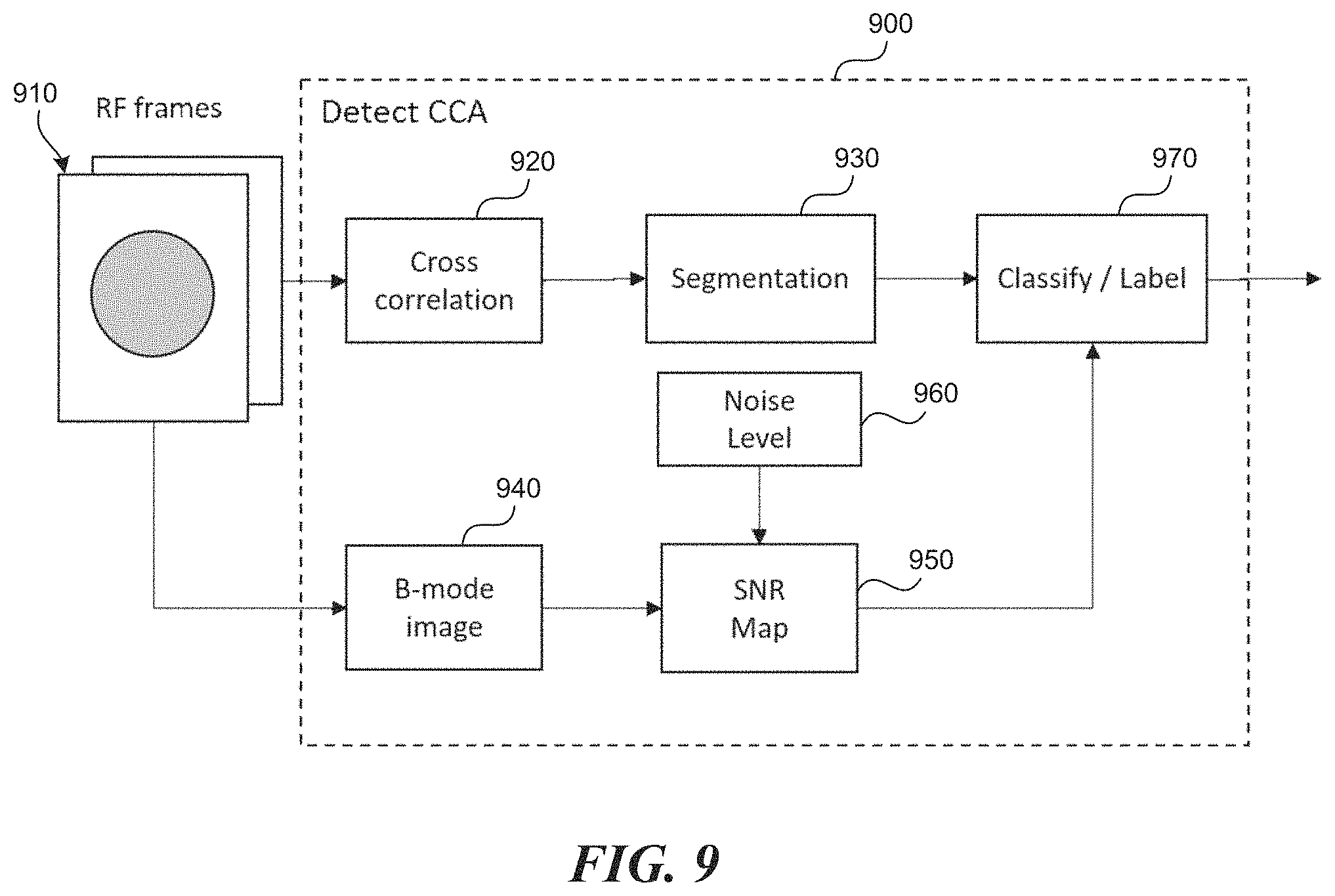 Patent US11771399 Figure 9 – Apparatus and method to guide ultrasound acquisition of the peripheral arteries in the transverse plane