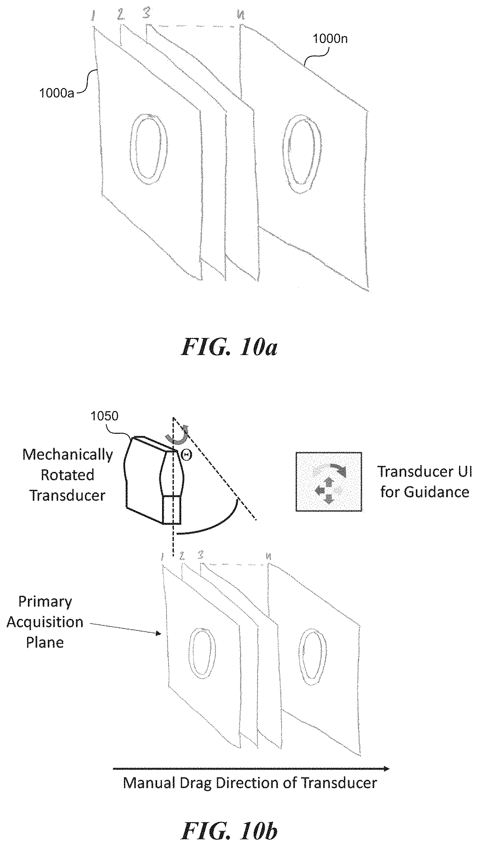 Patent US11771399 Figure 10 – Apparatus and method to guide ultrasound acquisition of the peripheral arteries in the transverse plane