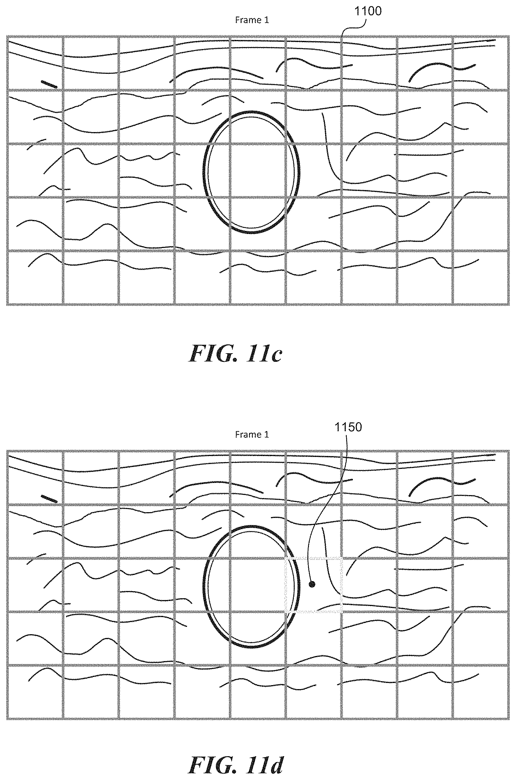 Patent US11771399 Figure 12 – Apparatus and method to guide ultrasound acquisition of the peripheral arteries in the transverse plane