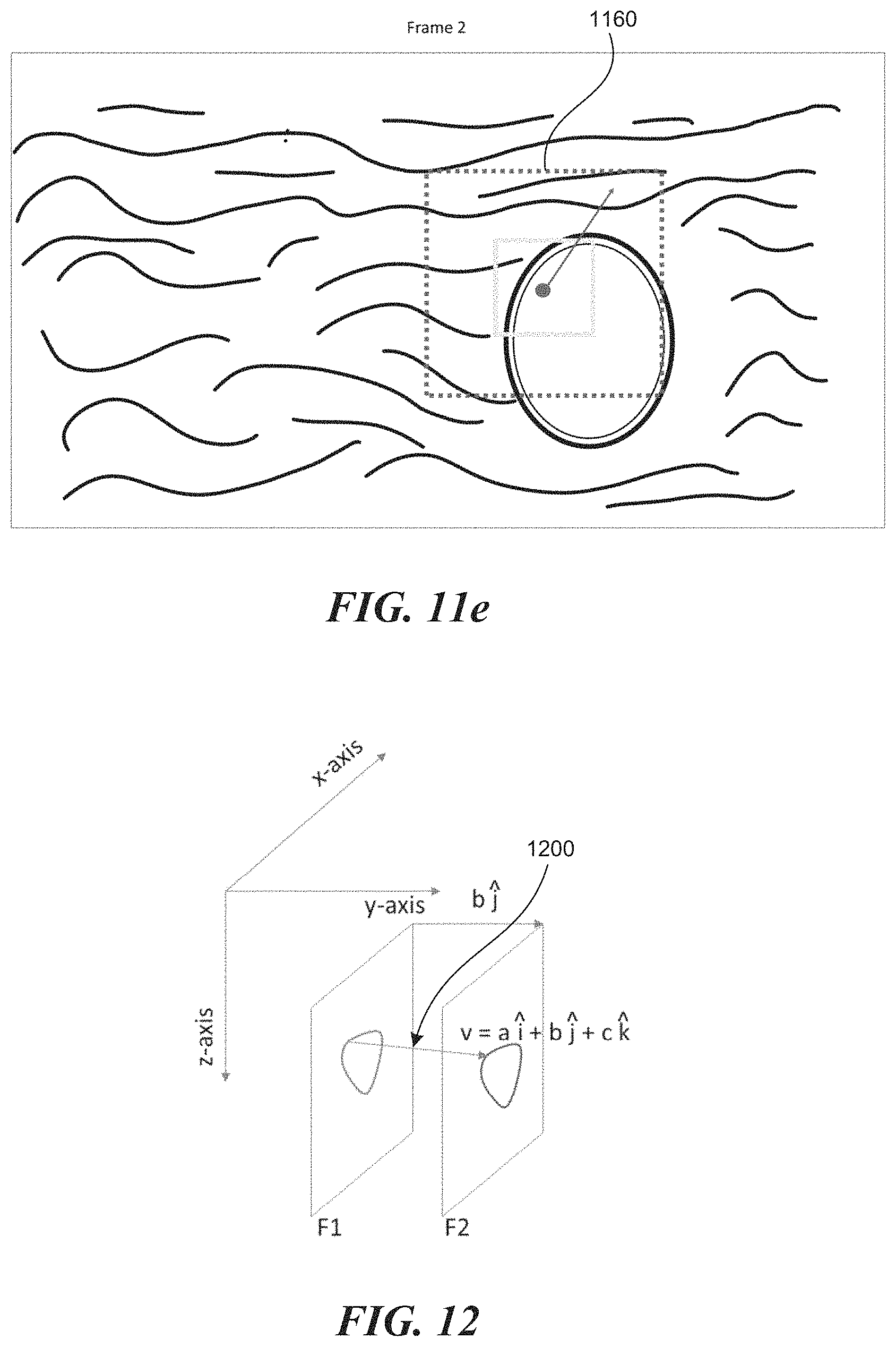 Patent US11771399 Figure 13 – Apparatus and method to guide ultrasound acquisition of the peripheral arteries in the transverse plane