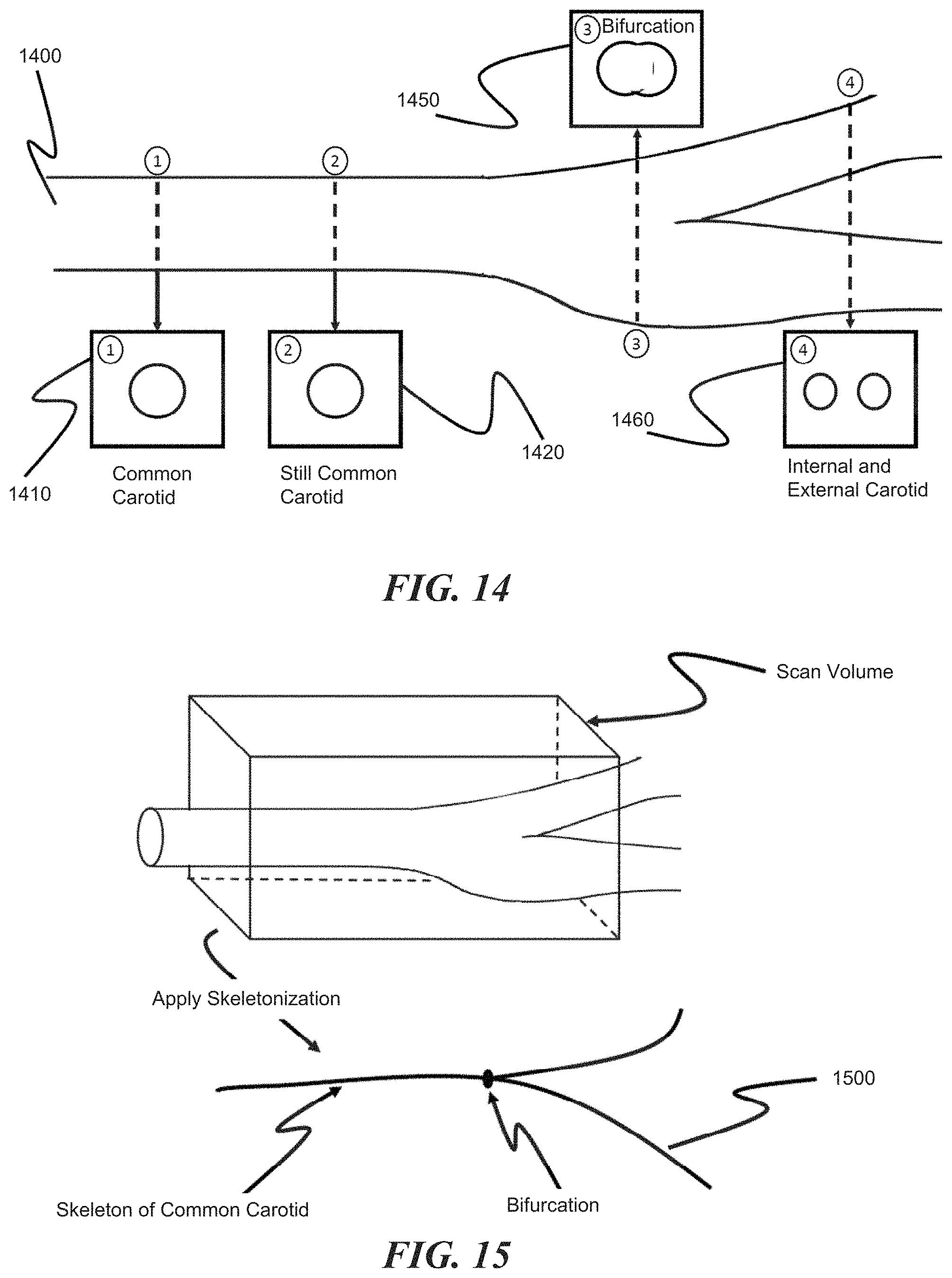Patent US11771399 Figure 15 – Apparatus and method to guide ultrasound acquisition of the peripheral arteries in the transverse plane