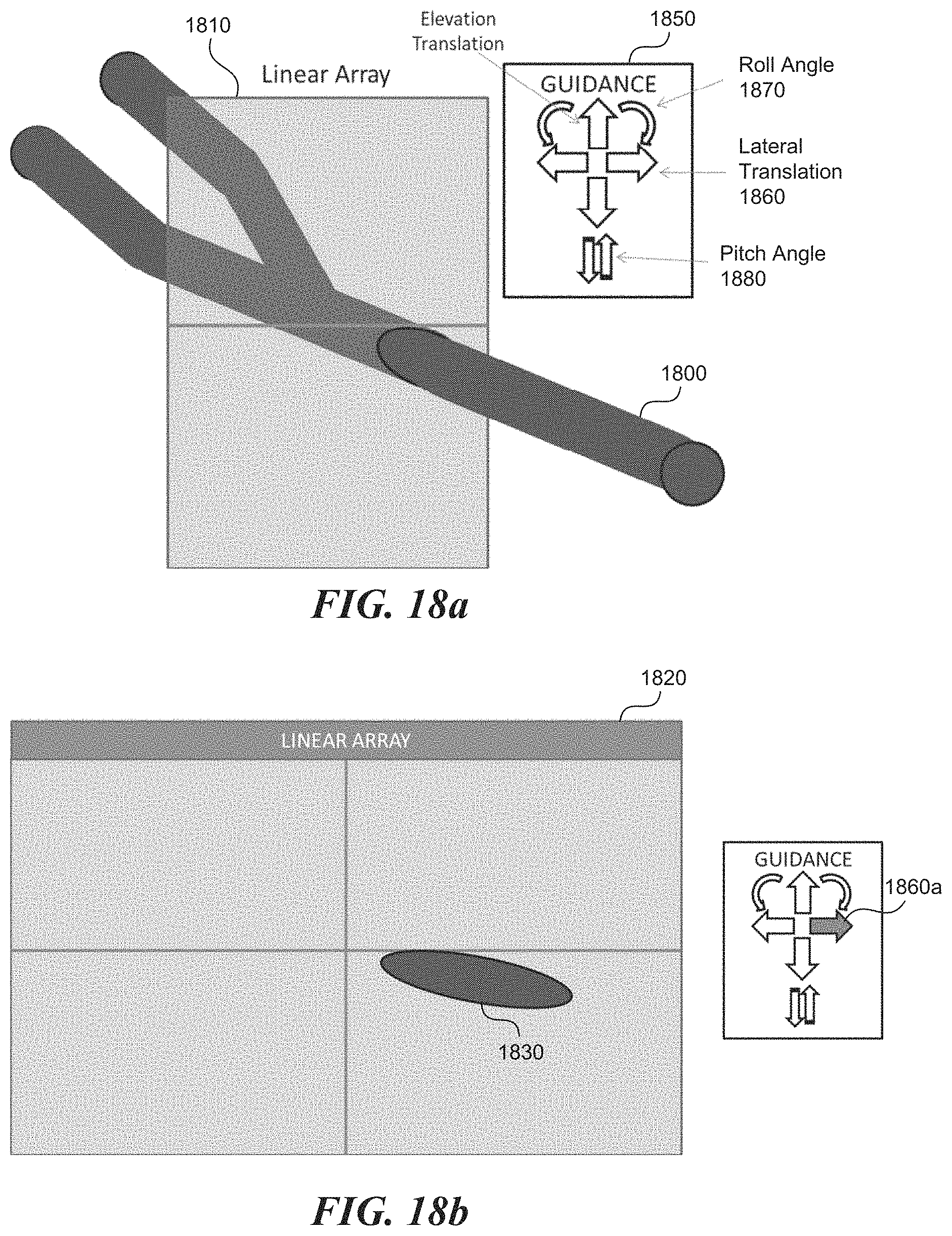 Patent US11771399 Figure 18 – Apparatus and method to guide ultrasound acquisition of the peripheral arteries in the transverse plane