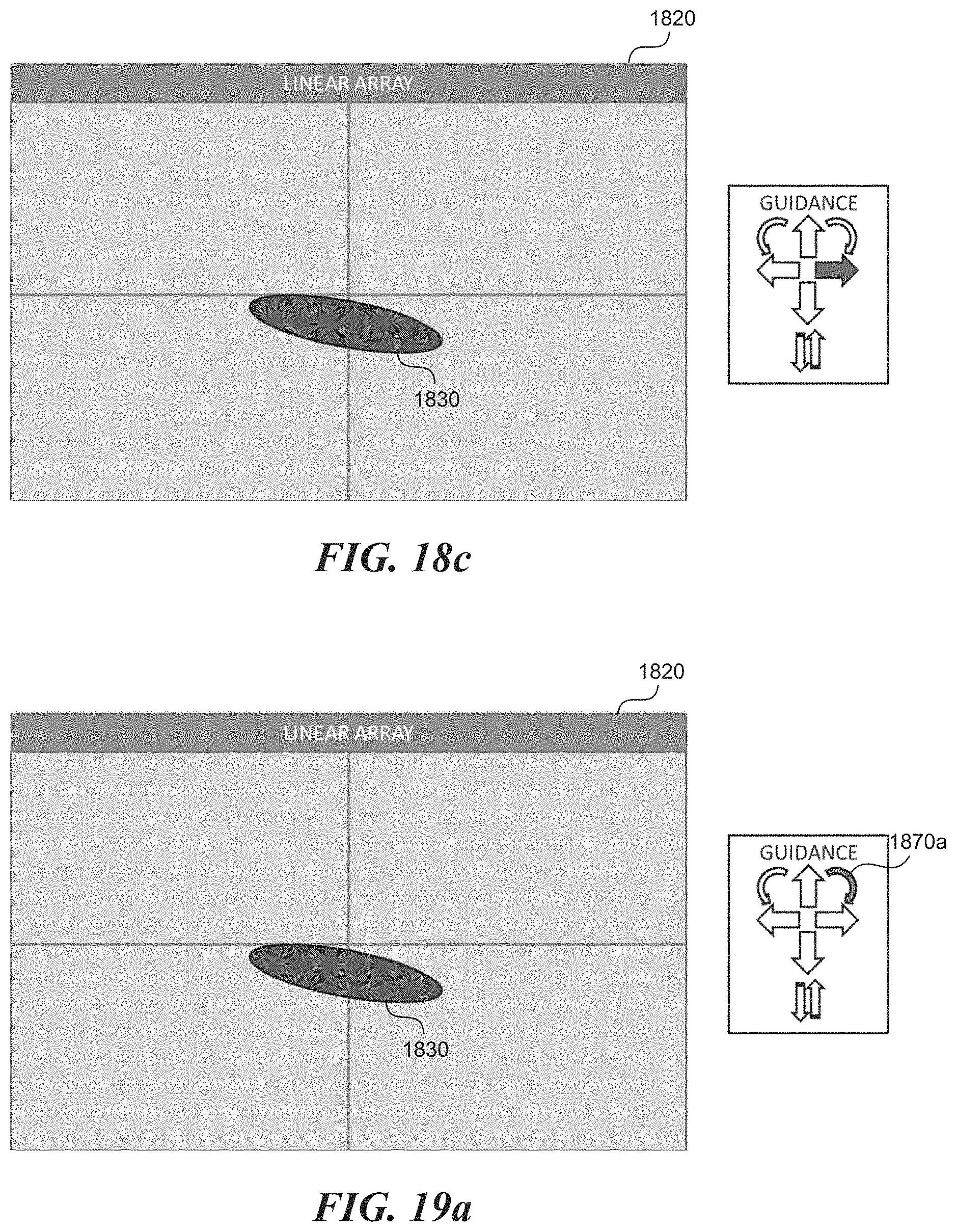 Patent US11771399 Figure 19 – Apparatus and method to guide ultrasound acquisition of the peripheral arteries in the transverse plane