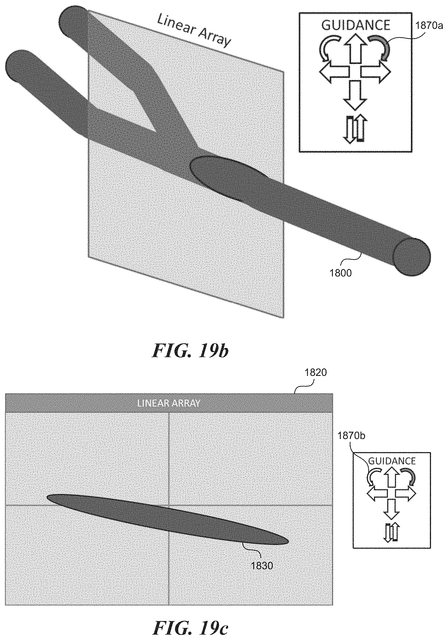 Patent US11771399 Figure 20 – Apparatus and method to guide ultrasound acquisition of the peripheral arteries in the transverse plane