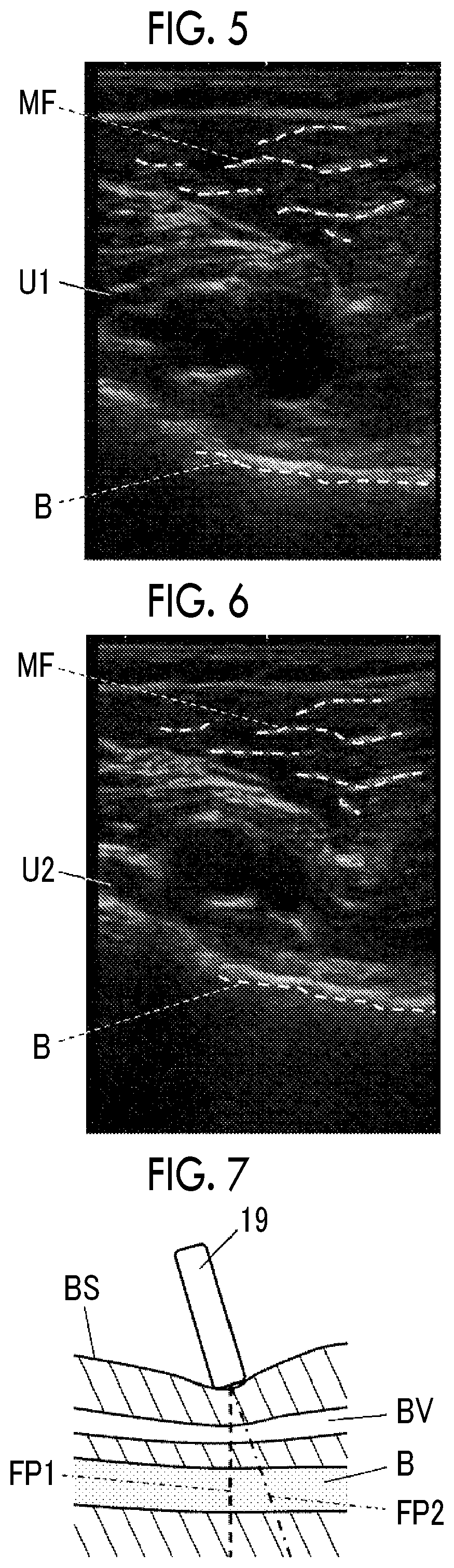 Patent US11771400 Figure 3 – Ultrasound diagnostic apparatus and method of controlling ultrasound diagnostic apparatus