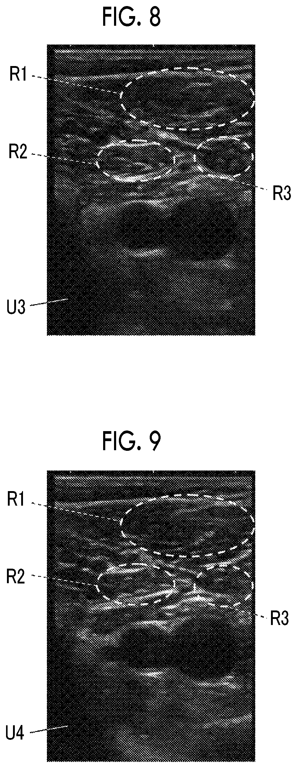 Patent US11771400 Figure 4 – Ultrasound diagnostic apparatus and method of controlling ultrasound diagnostic apparatus