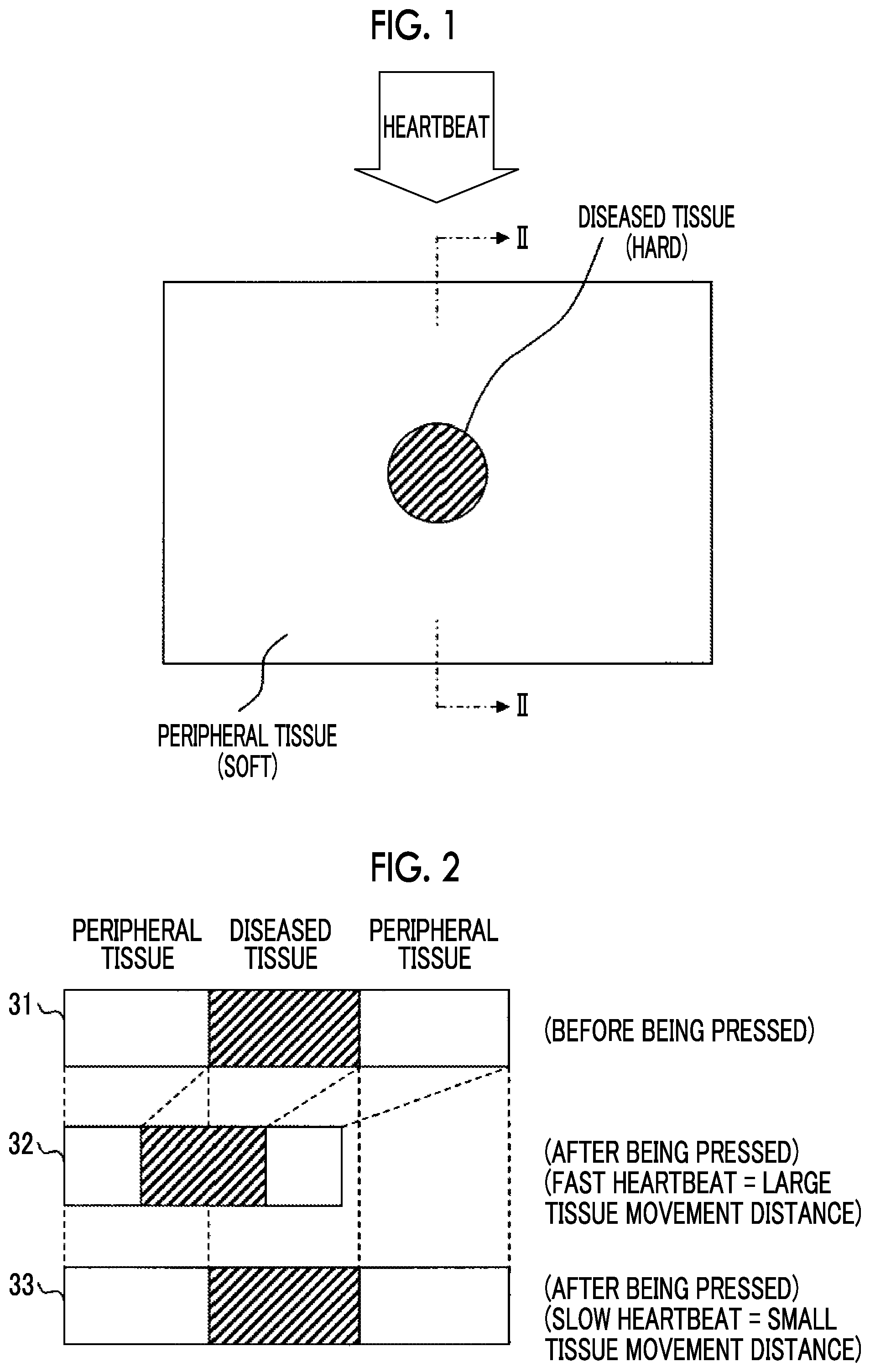 Patent US11771404 Figure 1 – Acoustic wave diagnostic apparatus and control method thereof