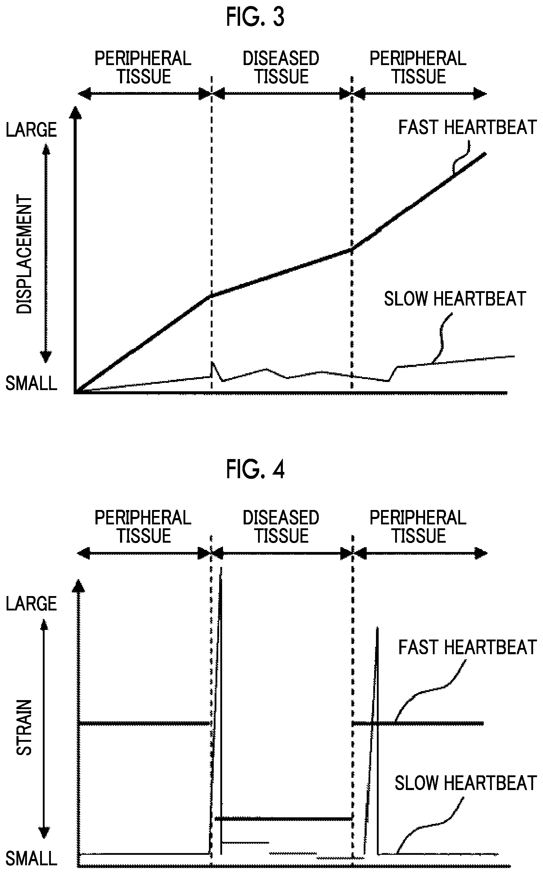 Patent US11771404 Figure 2 – Acoustic wave diagnostic apparatus and control method thereof