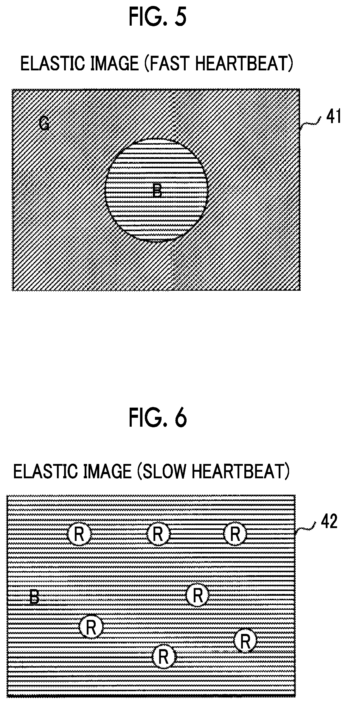 Patent US11771404 Figure 3 – Acoustic wave diagnostic apparatus and control method thereof