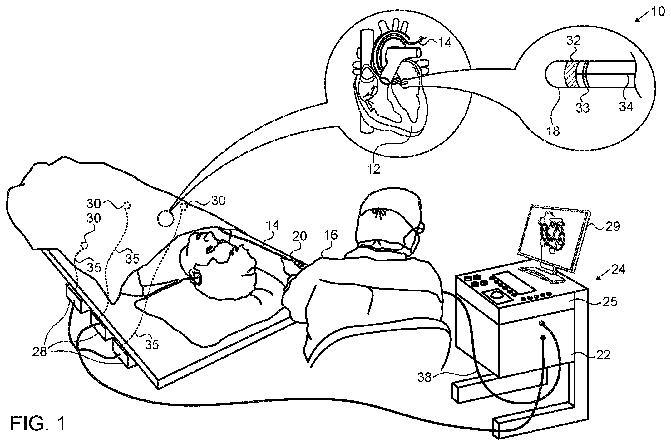 Patent US11771407 Figure 1 – Assistive manual zeroing visualization
