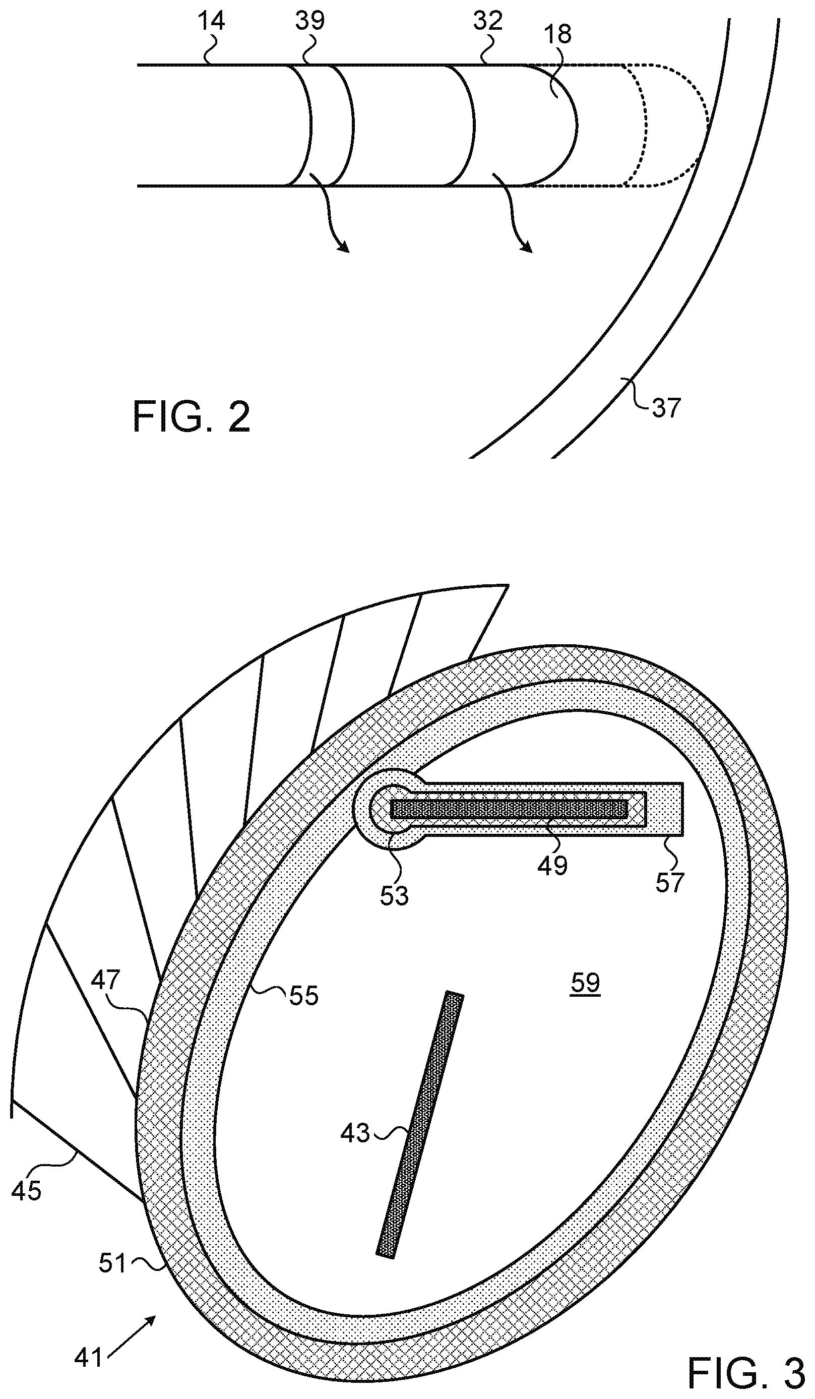 Patent US11771407 Figure 2 – Assistive manual zeroing visualization