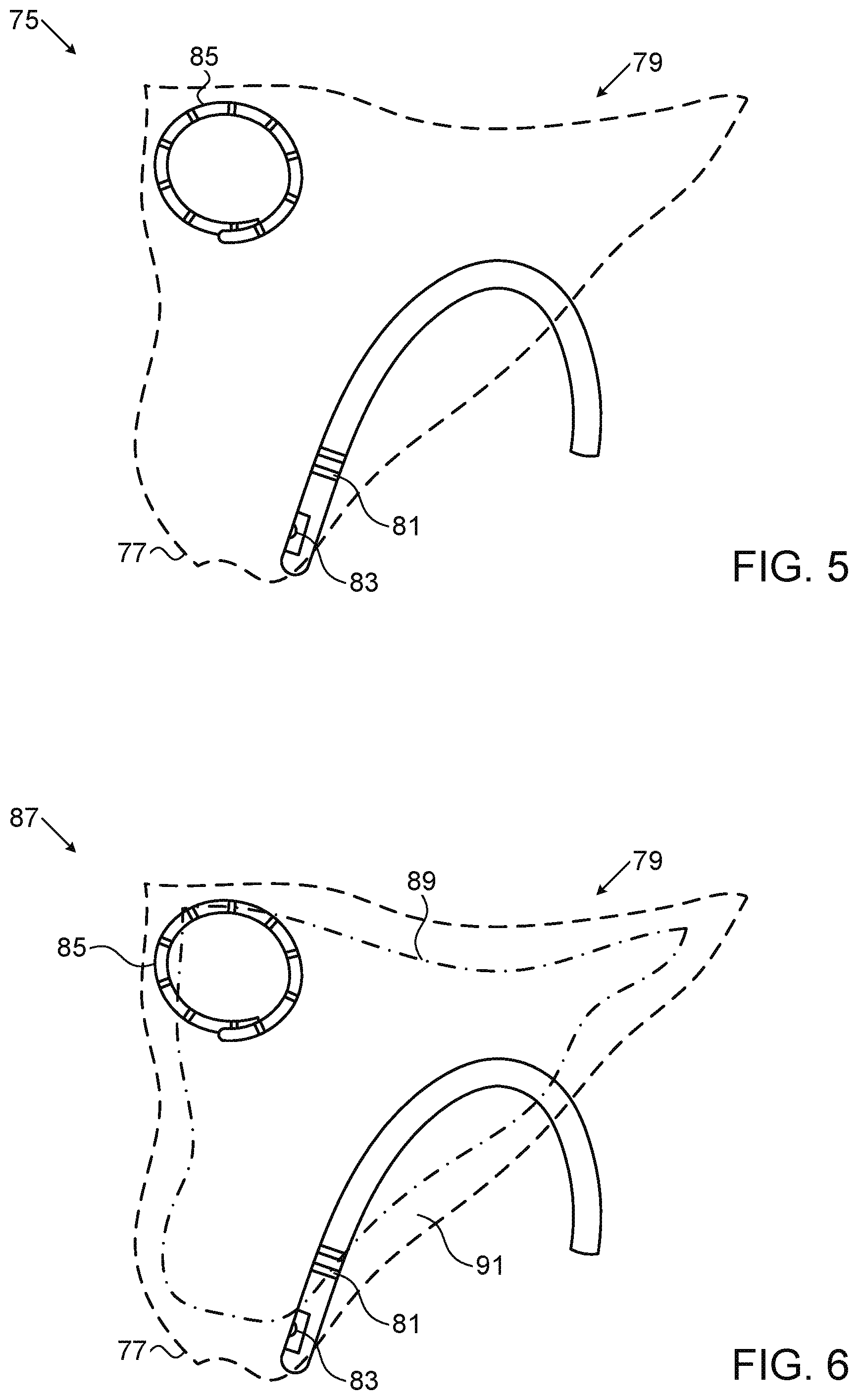 Patent US11771407 Figure 4 – Assistive manual zeroing visualization