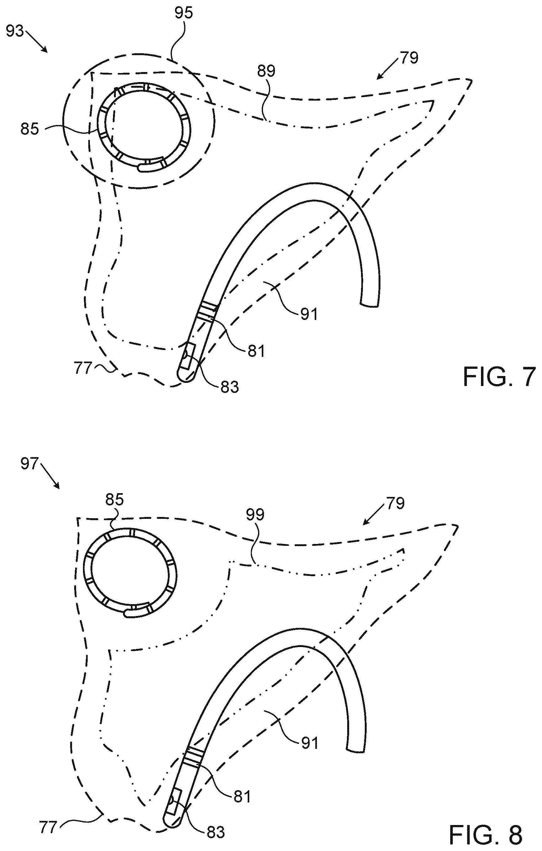 Patent US11771407 Figure 5 – Assistive manual zeroing visualization
