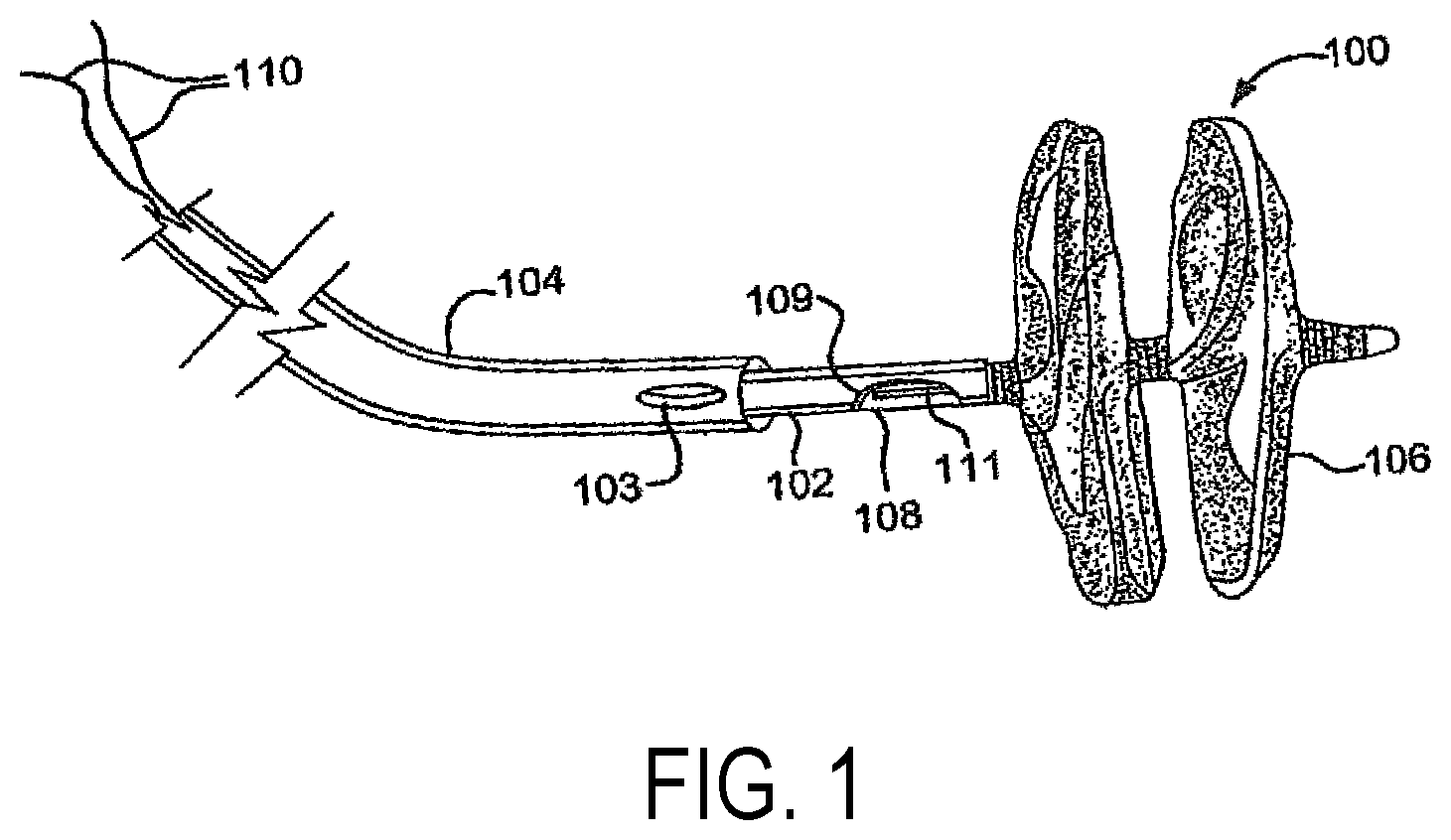 Patent US11771408 Figure 1 – Sealing device and delivery system