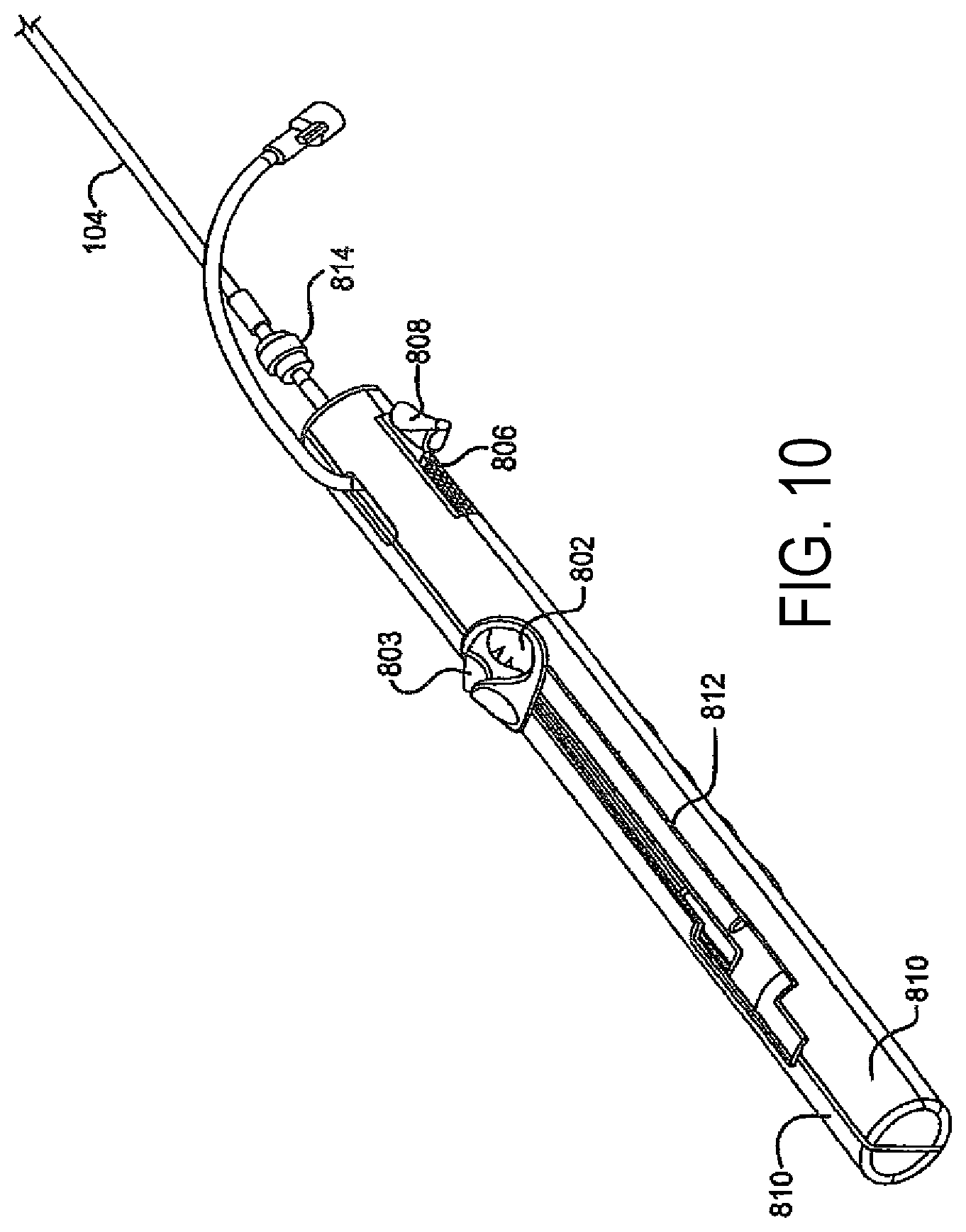 Patent US11771408 Figure 10 – Sealing device and delivery system
