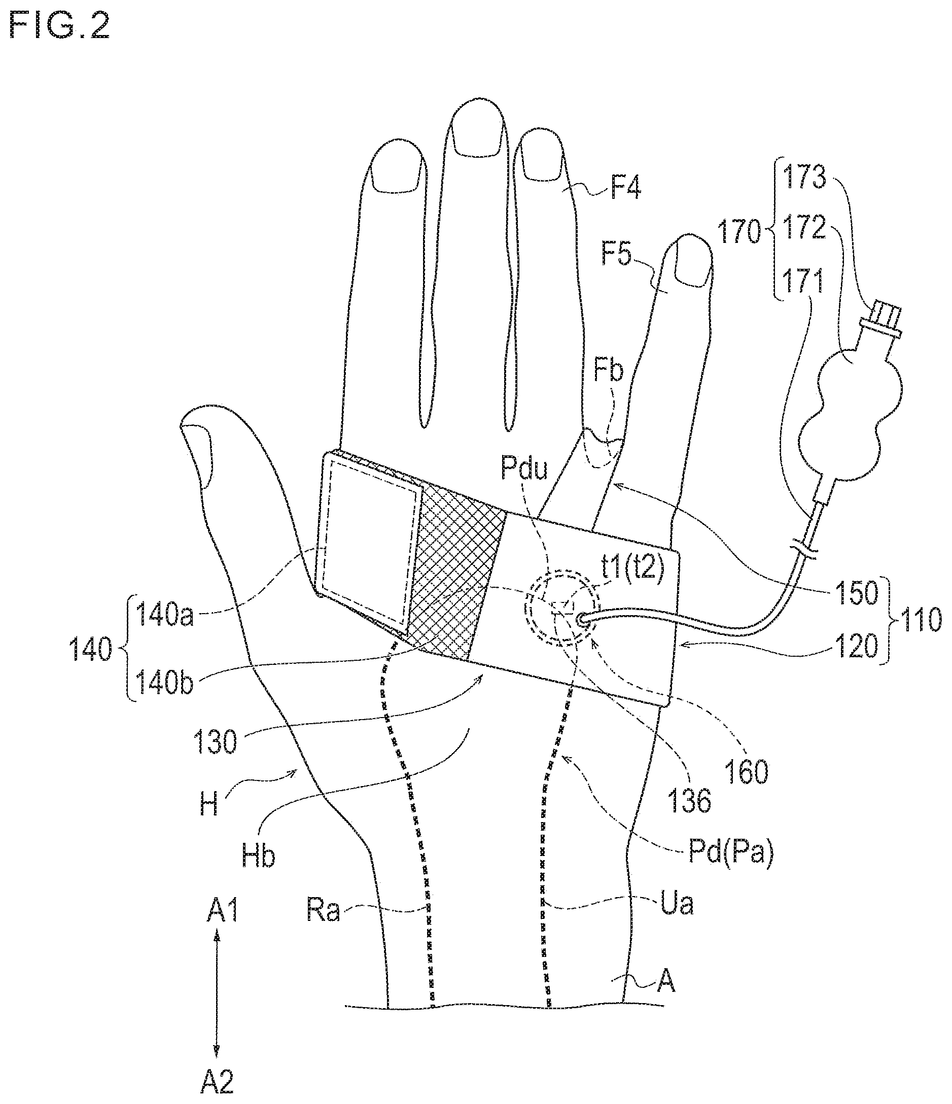 Patent US11771409 Figure 2 – Treatment method