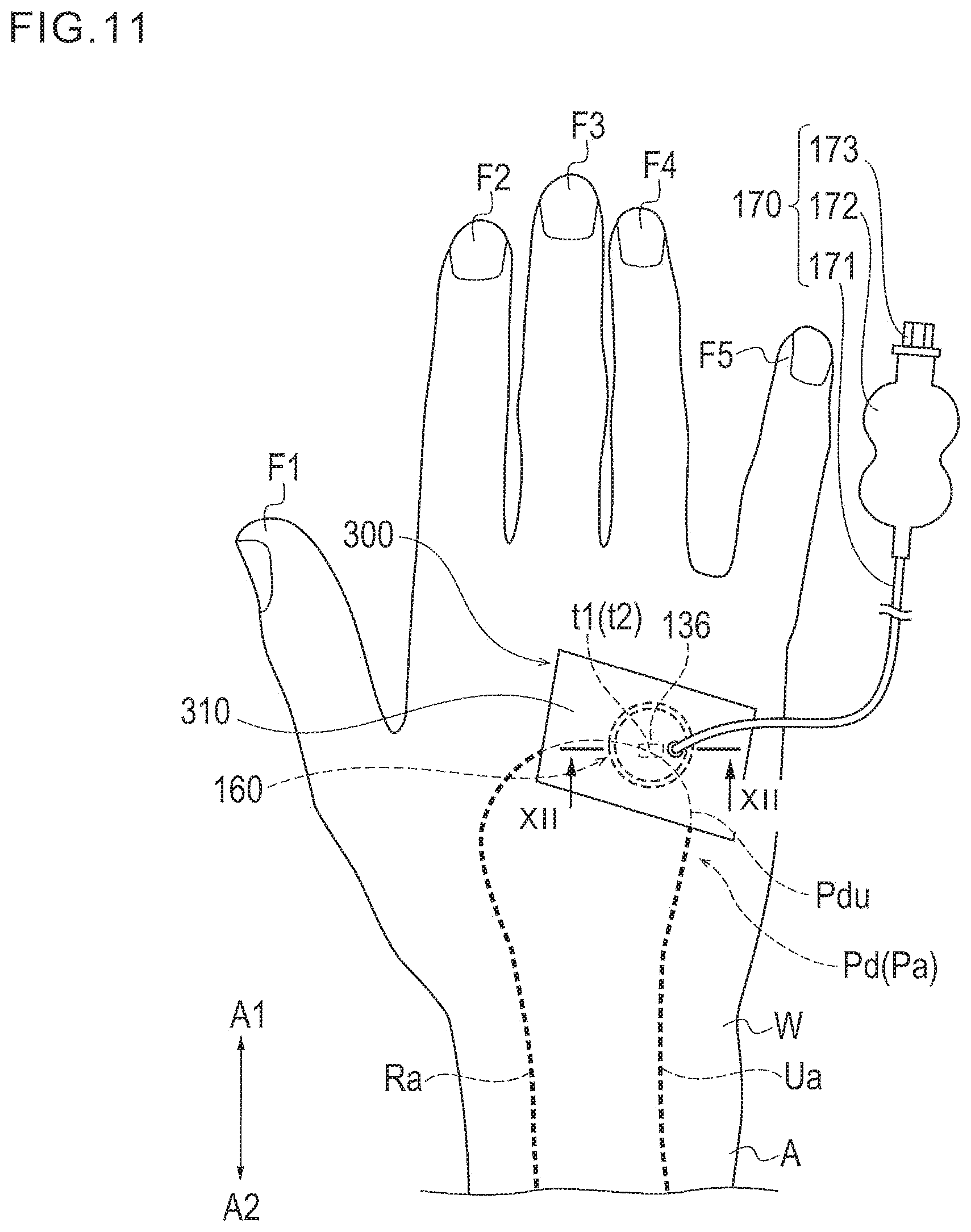 Patent US11771409 Figure 8 – Treatment method