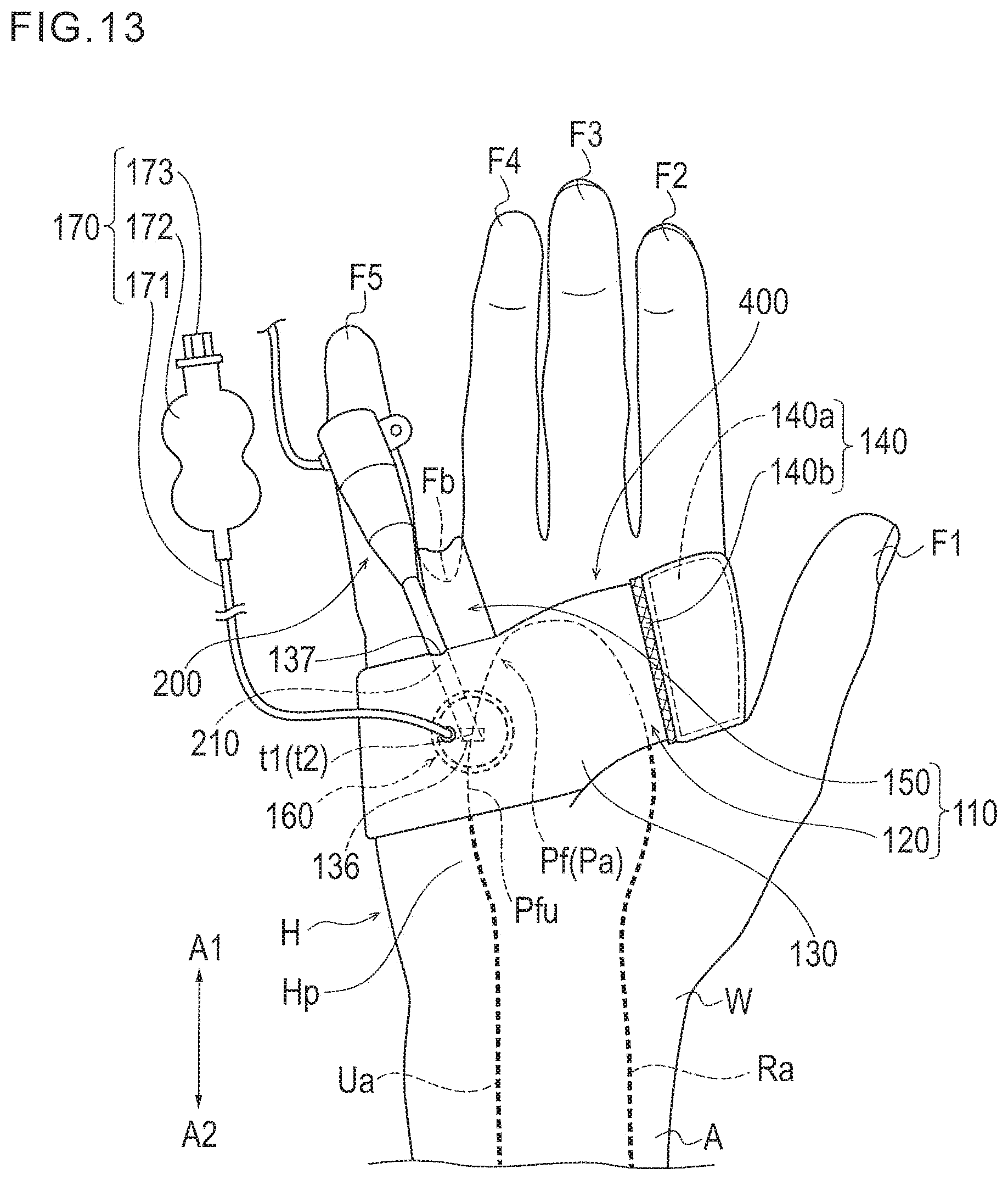 Patent US11771409 Figure 10 – Treatment method