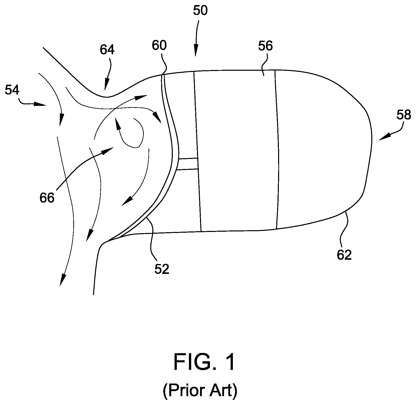 Patent US11771410 Figure 1 – Devices and methods for the treatment of vascular abnormalities
