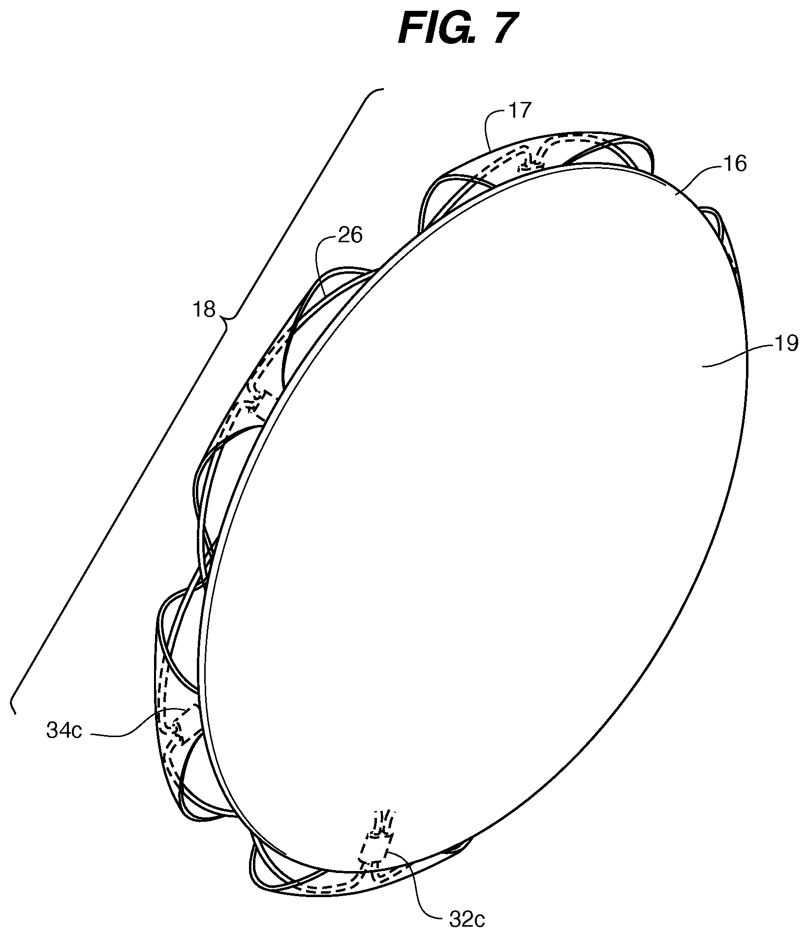 Patent US11771411 Figure 7 – PFO device
