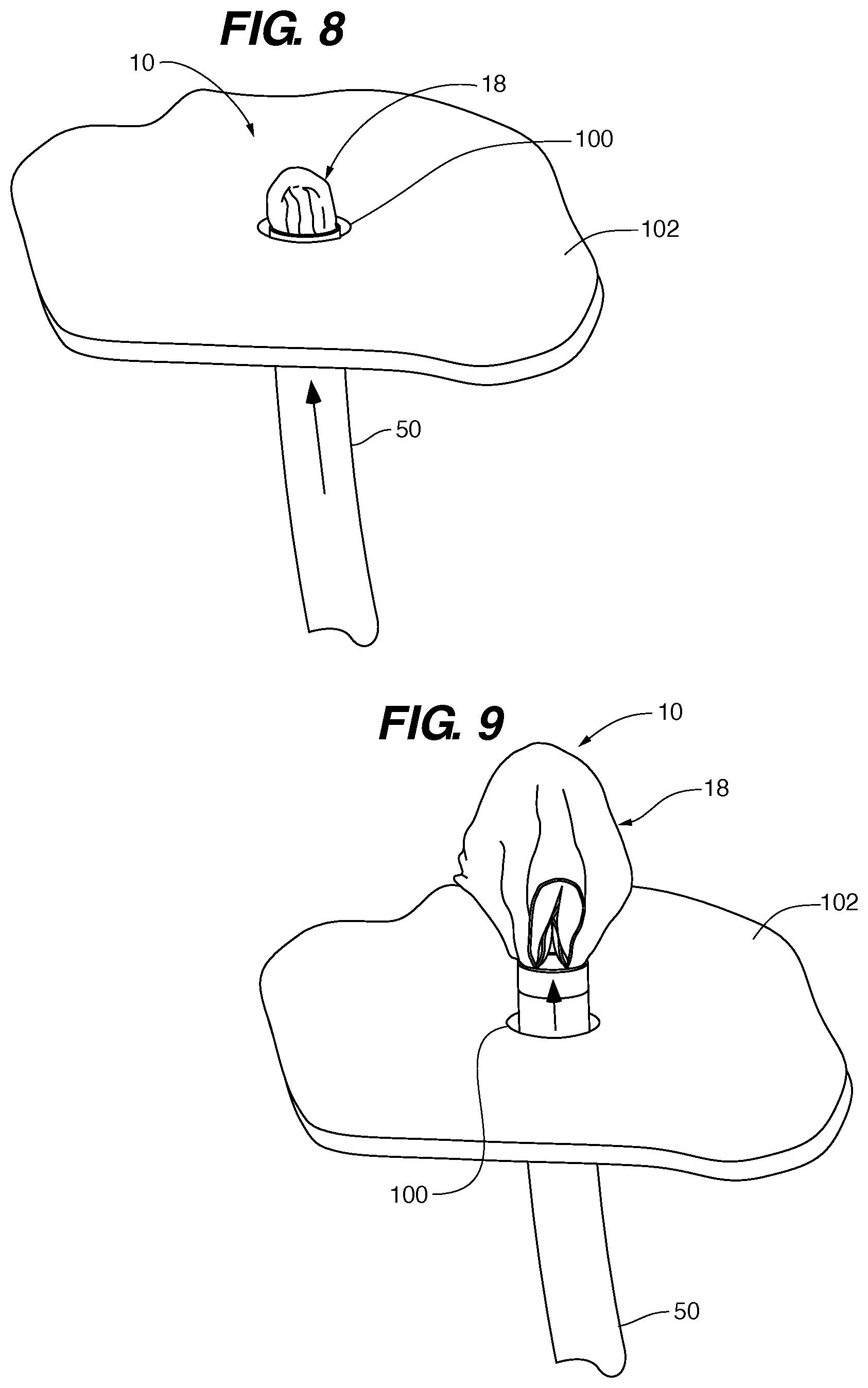 Patent US11771411 Figure 8 – PFO device