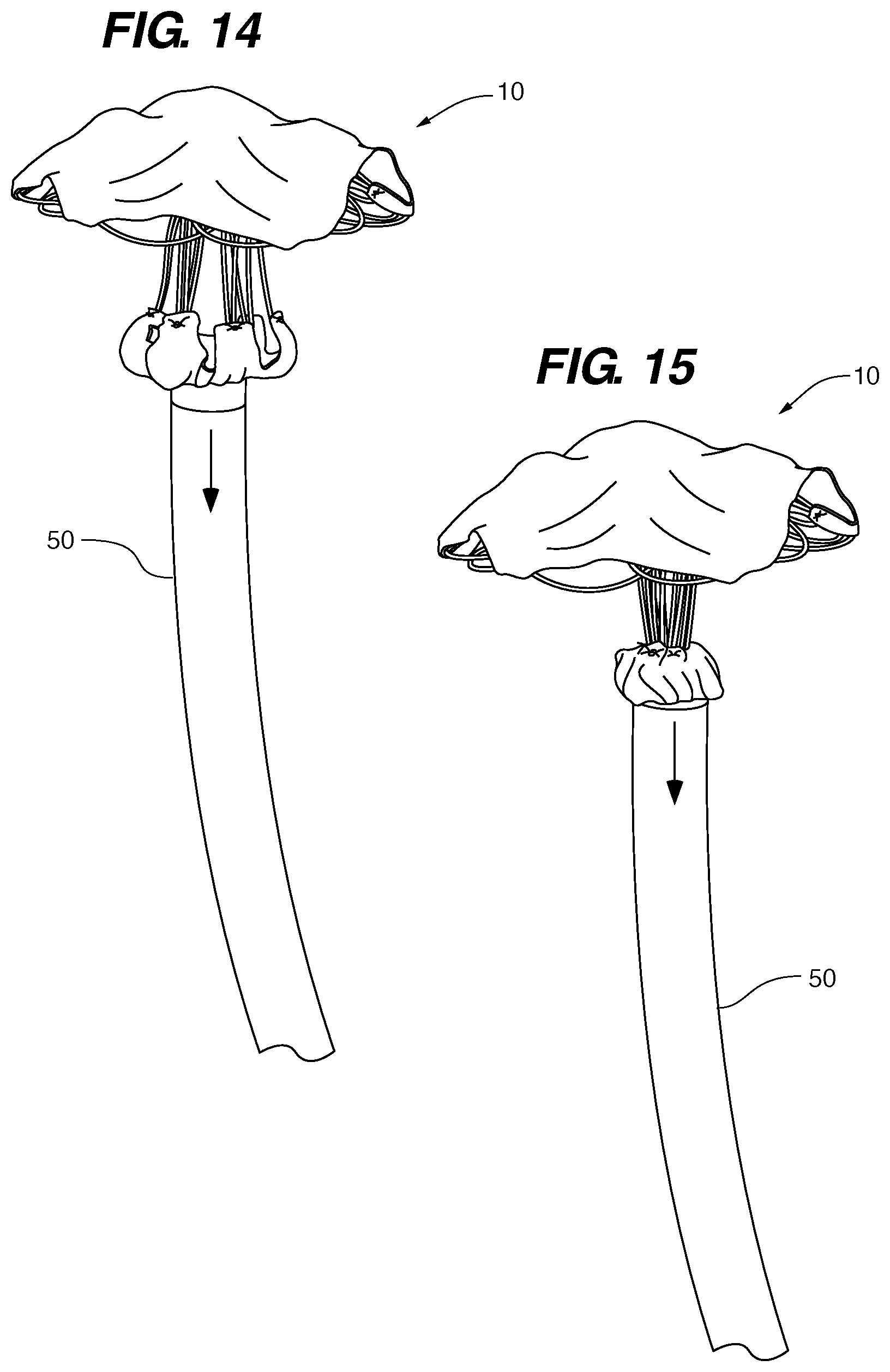 Patent US11771411 Figure 11 – PFO device