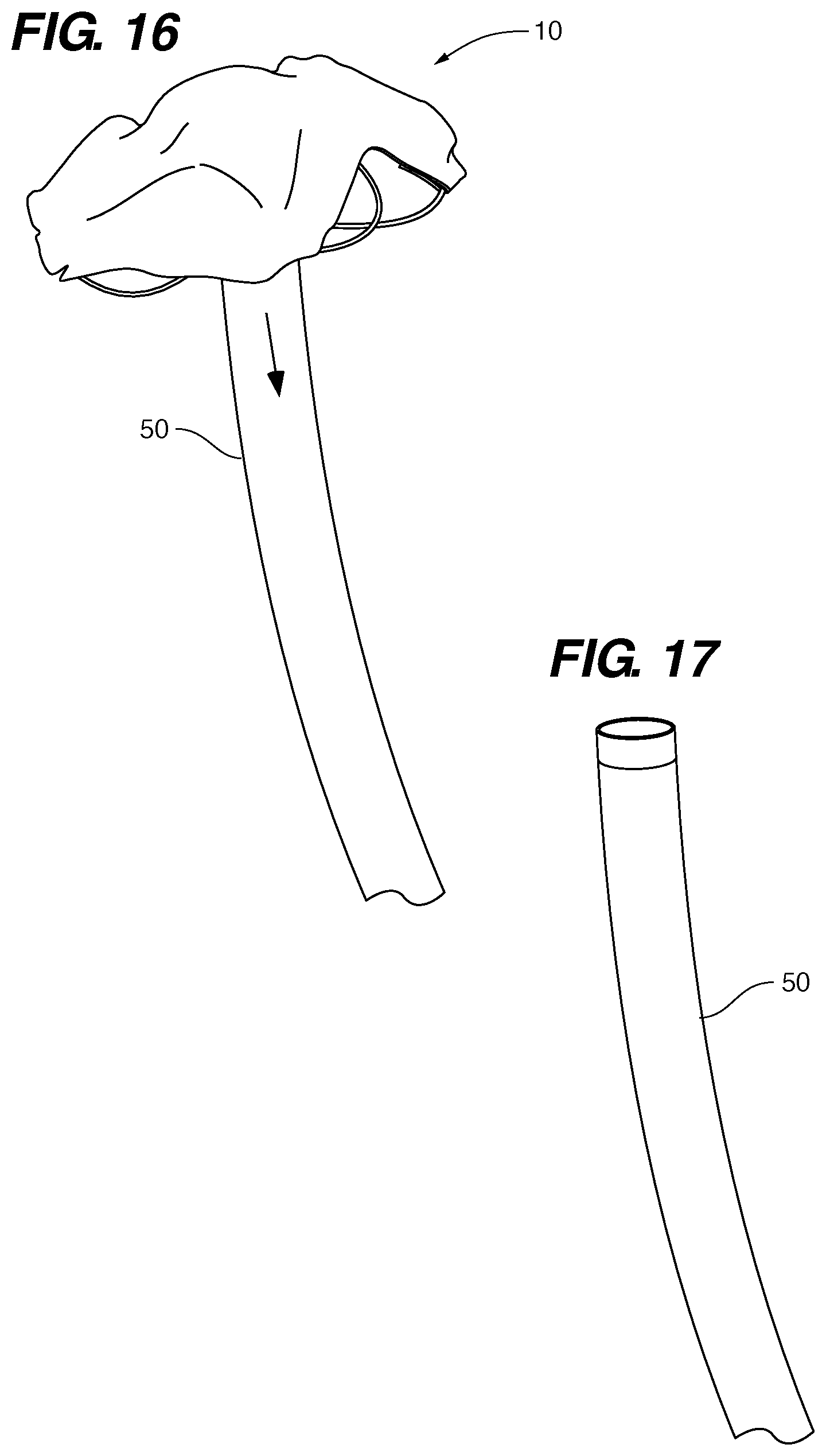 Patent US11771411 Figure 12 – PFO device