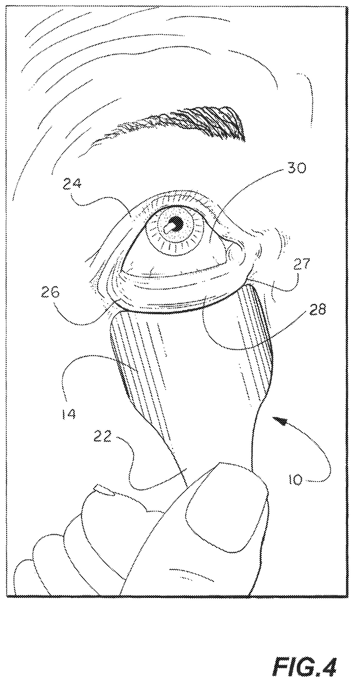 Patent US11771412 Figure 3 – Eyelid flipper tool