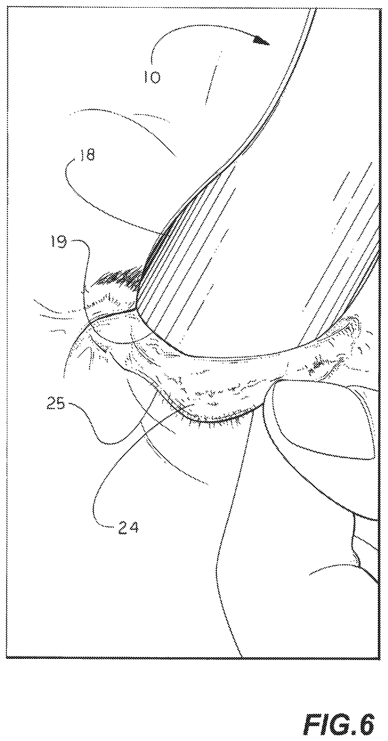 Patent US11771412 Figure 5 – Eyelid flipper tool