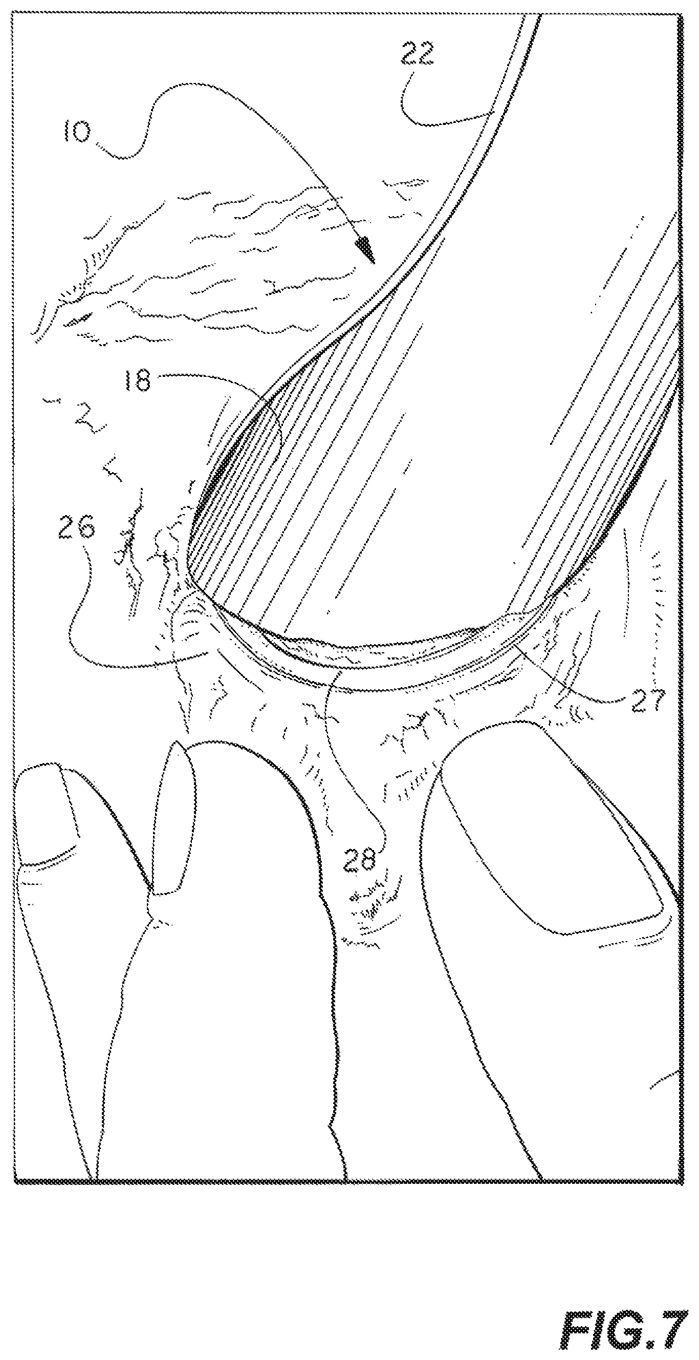 Patent US11771412 Figure 6 – Eyelid flipper tool