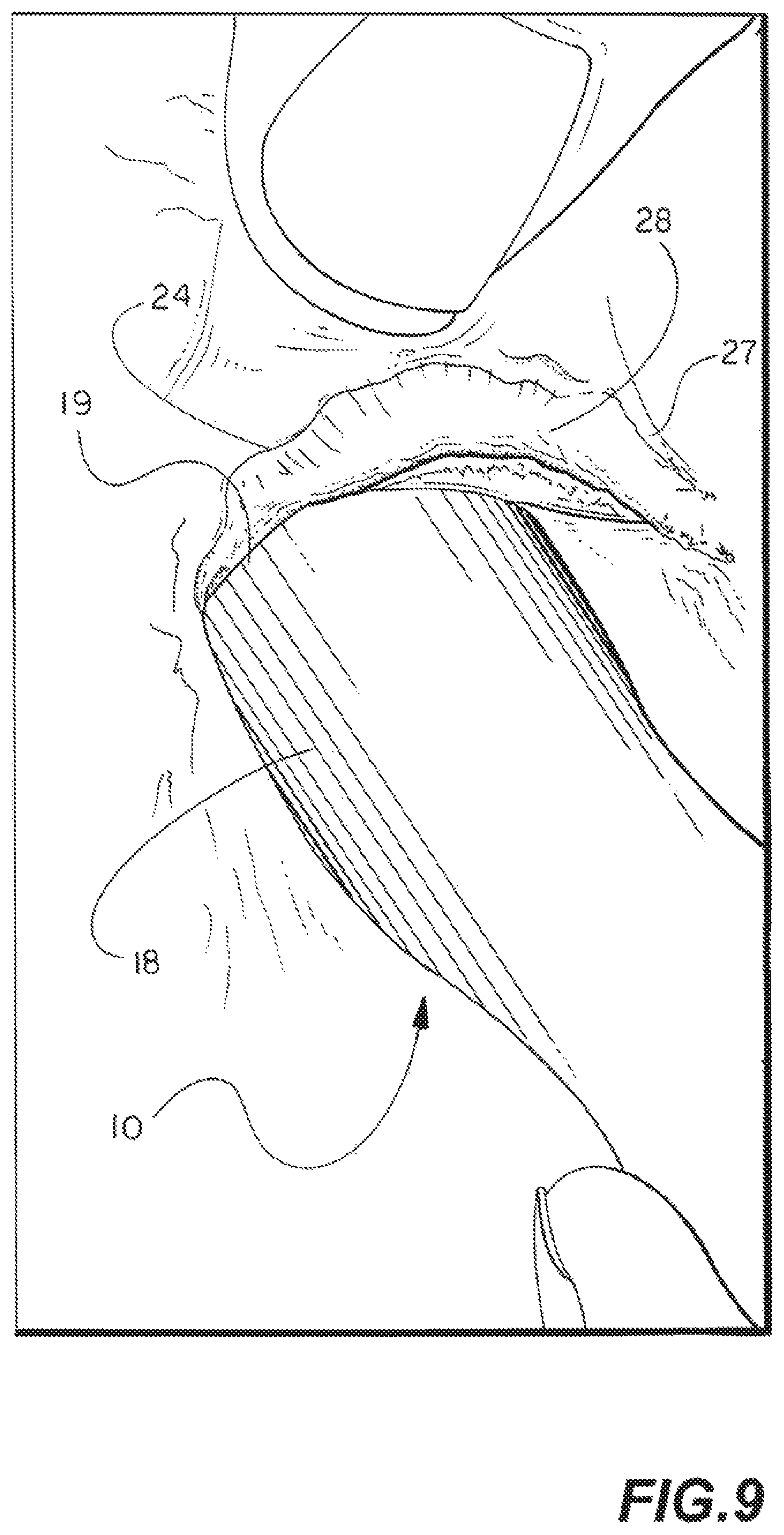 Patent US11771412 Figure 8 – Eyelid flipper tool