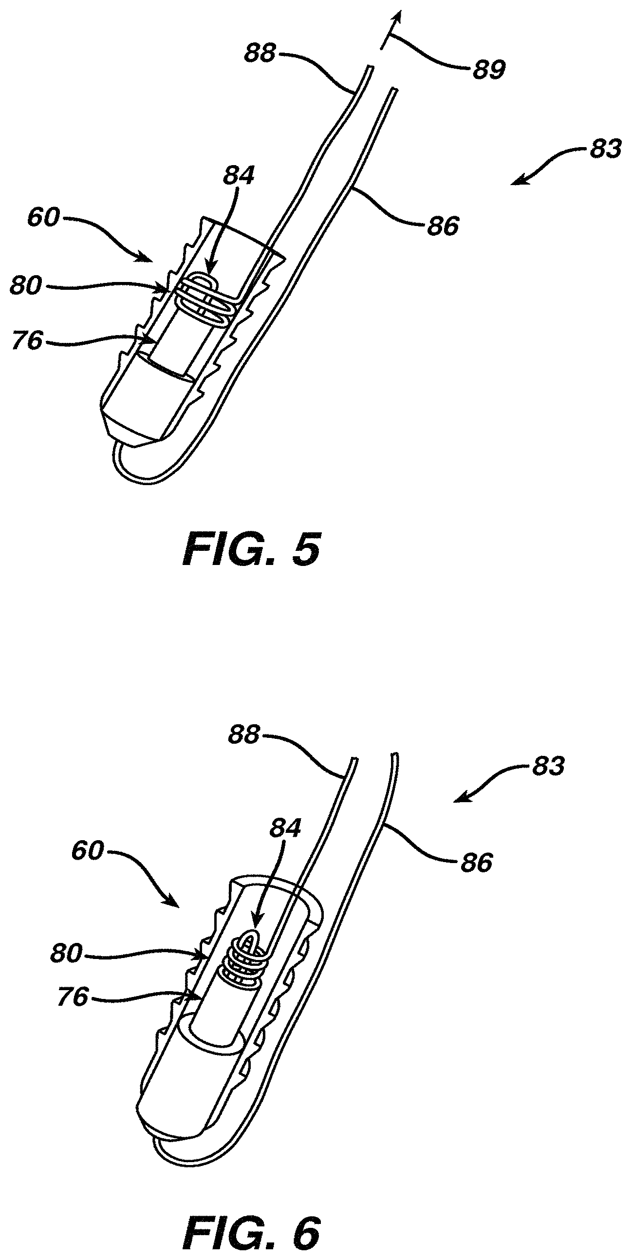 Patent US11771414 Figure 3 – Surgical filament assemblies